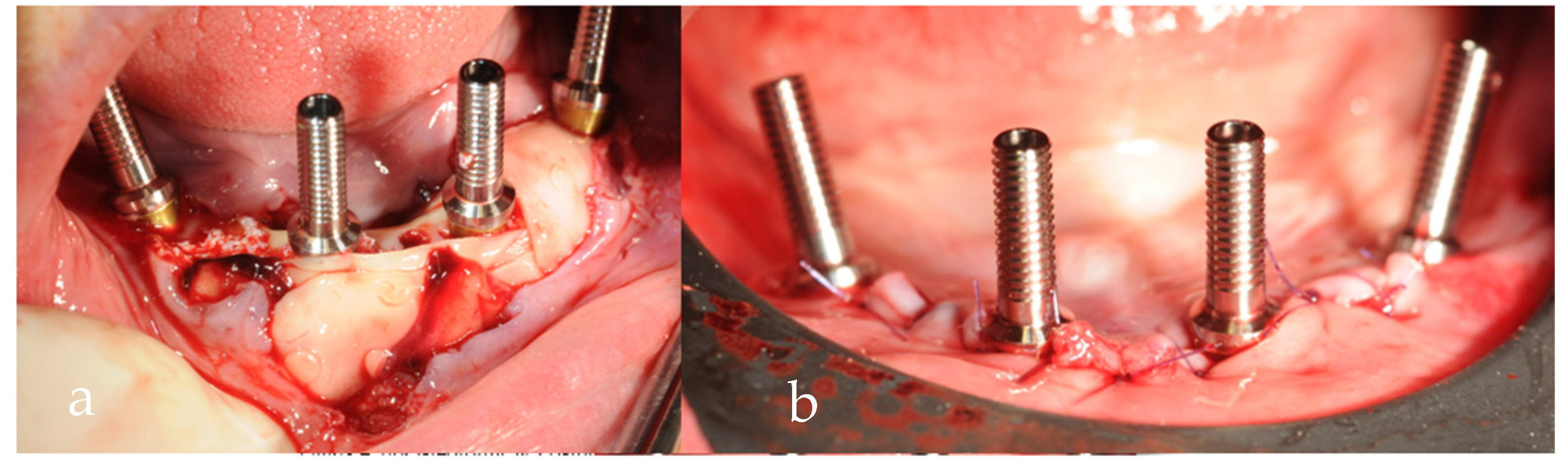 Prosthesis 05 00017 g015 Prosthesis 05 00017 g015