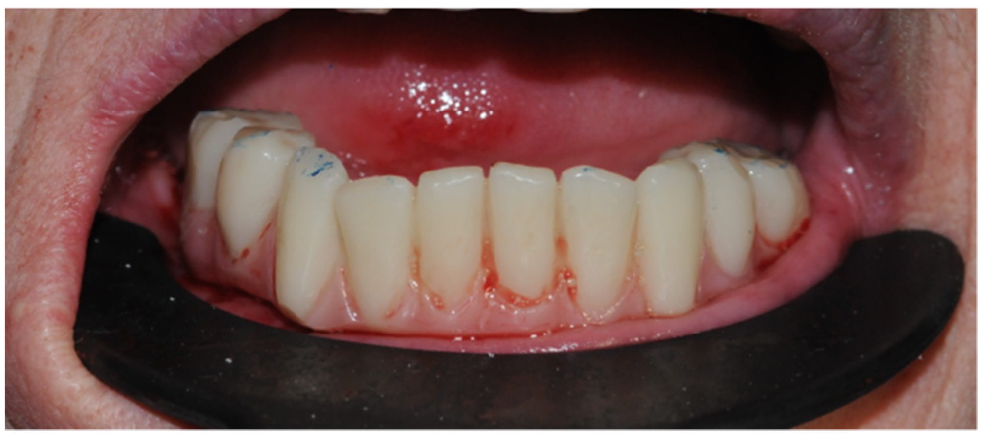 Prosthesis 05 00017 g016 Prosthesis 05 00017 g016