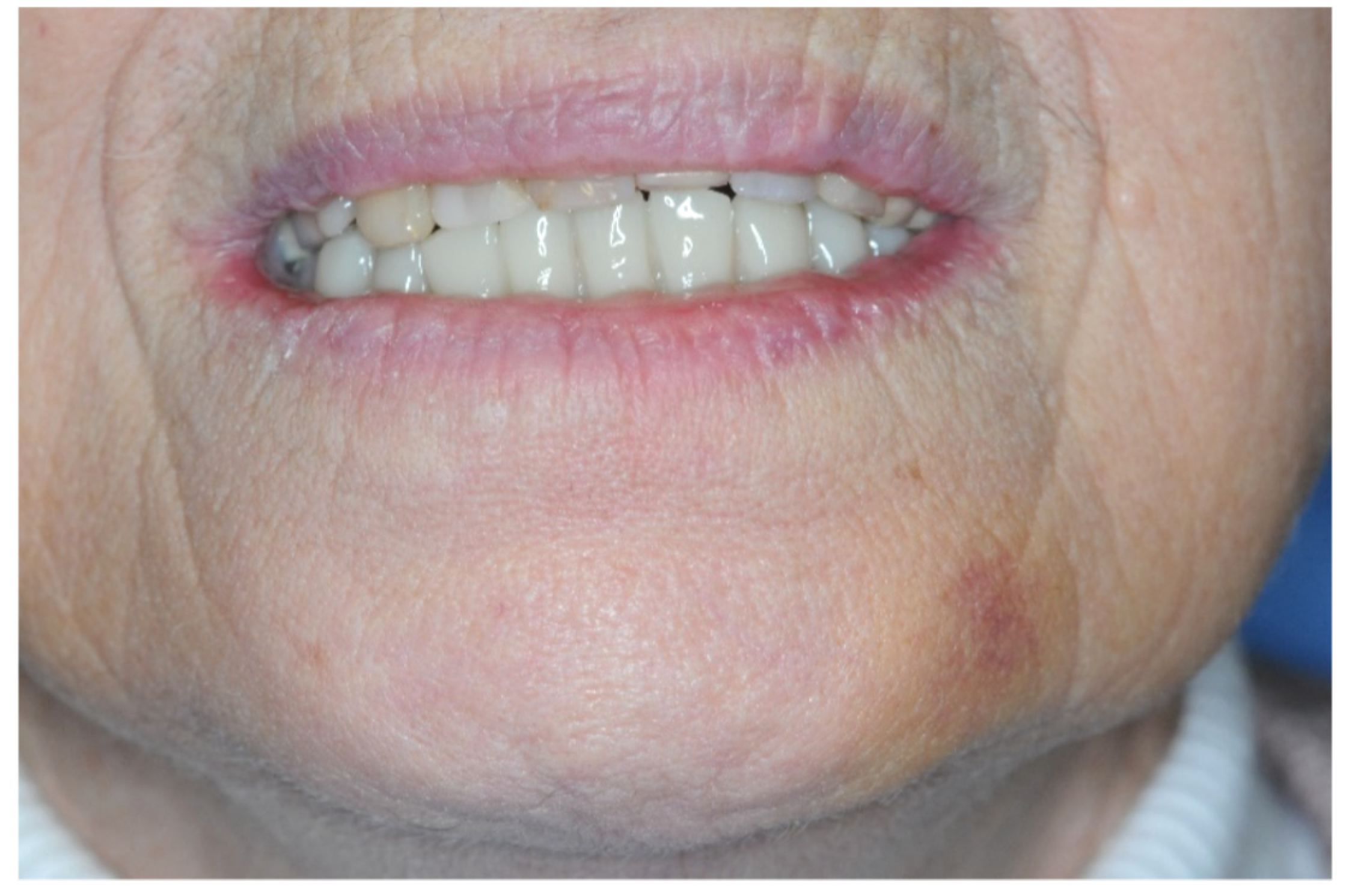 Prosthesis 05 00017 g018 Prosthesis 05 00017 g018