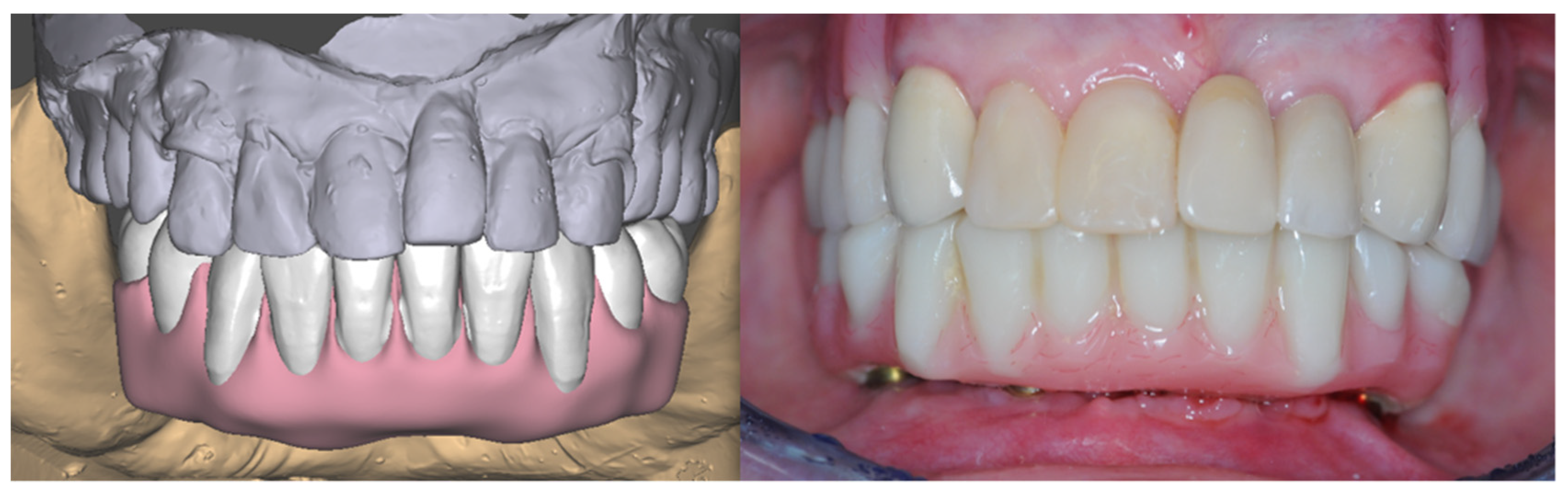 Prosthesis 05 00017 g019 Prosthesis 05 00017 g019