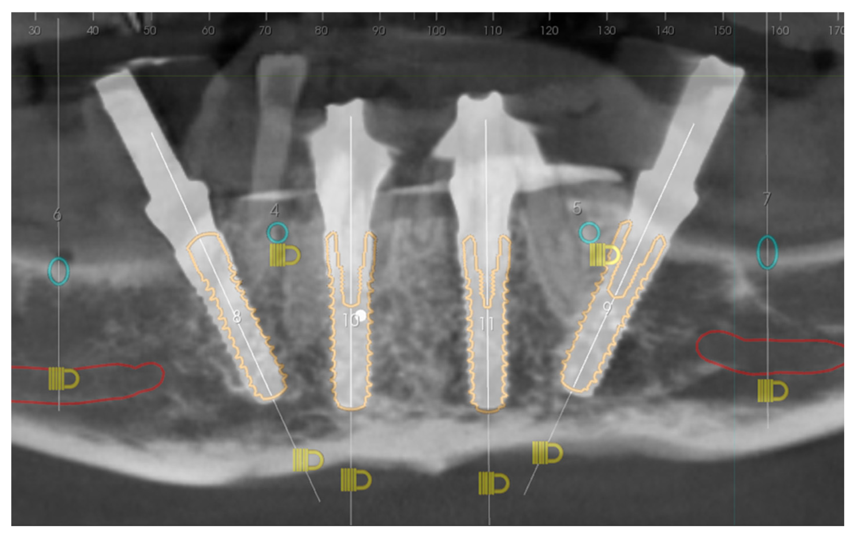 Prosthesis 05 00017 g020 Prosthesis 05 00017 g020