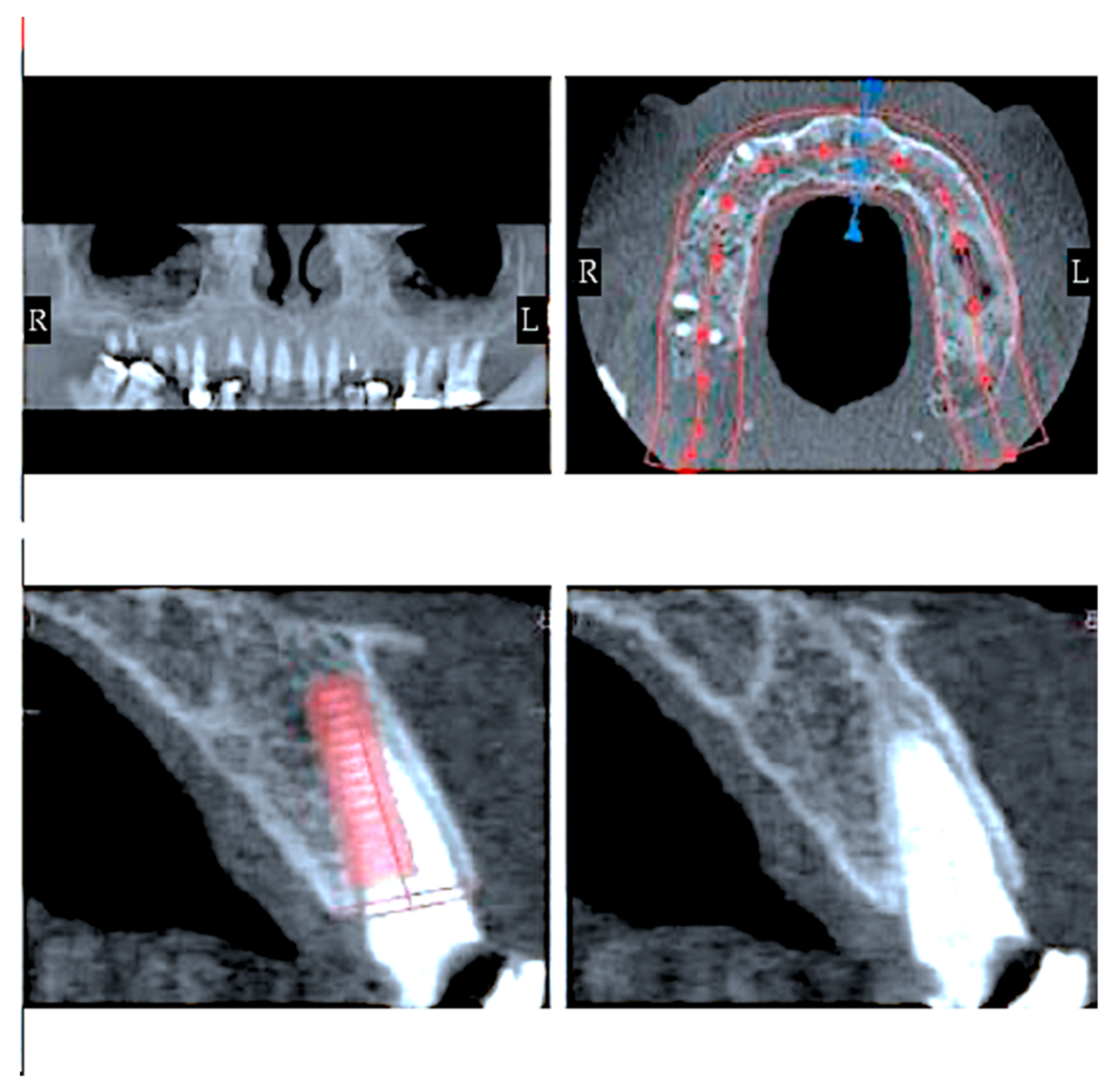Prosthesis 05 00018 g003 Prosthesis 05 00018 g003