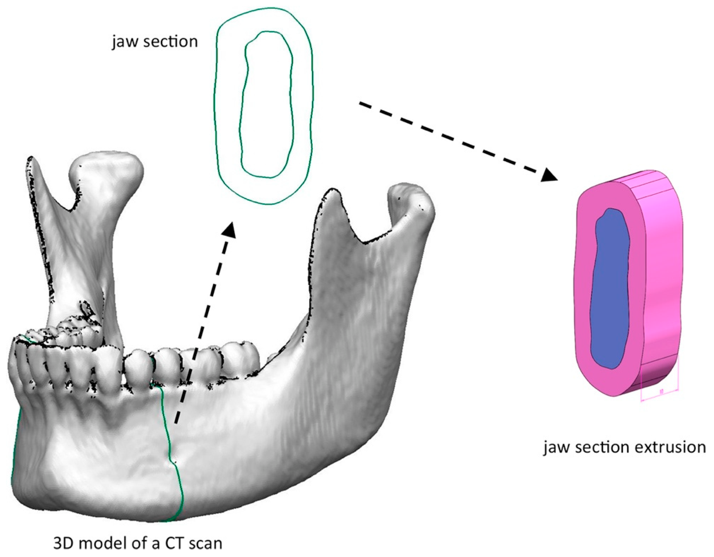 Prosthesis 05 00018 g004 Prosthesis 05 00018 g004