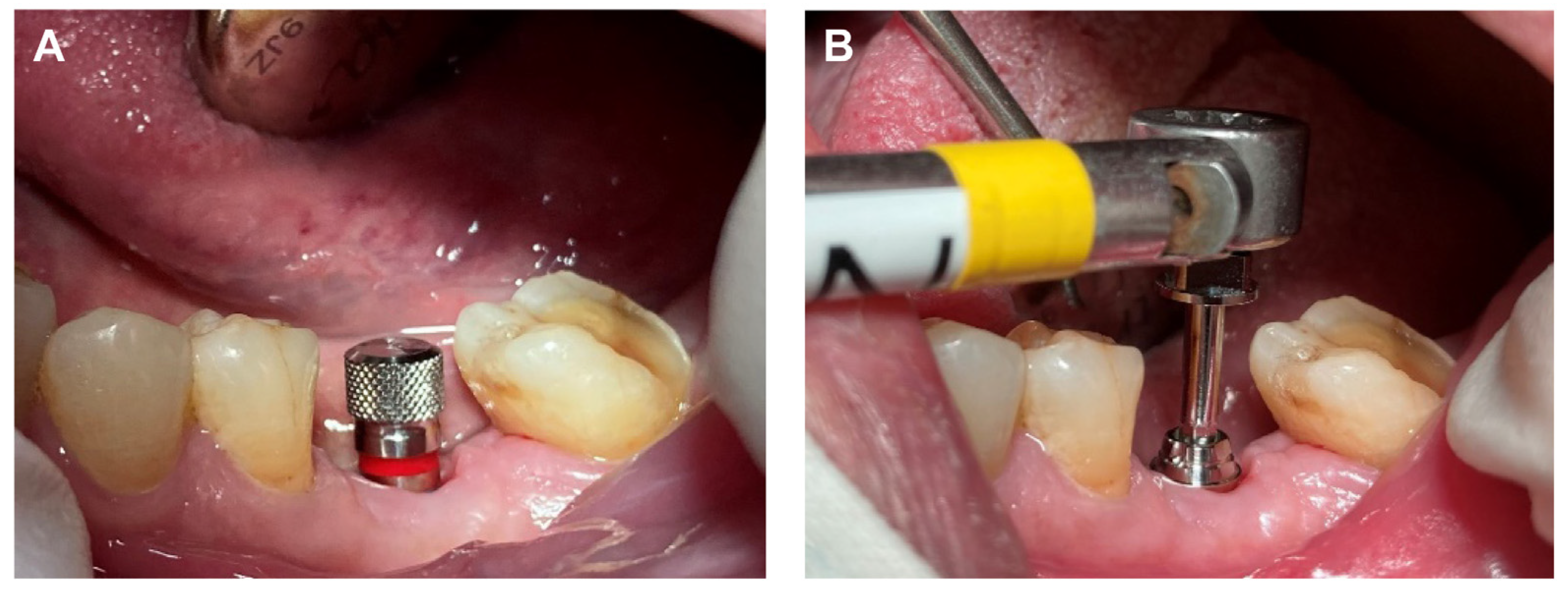 Prosthesis 05 00027 g002