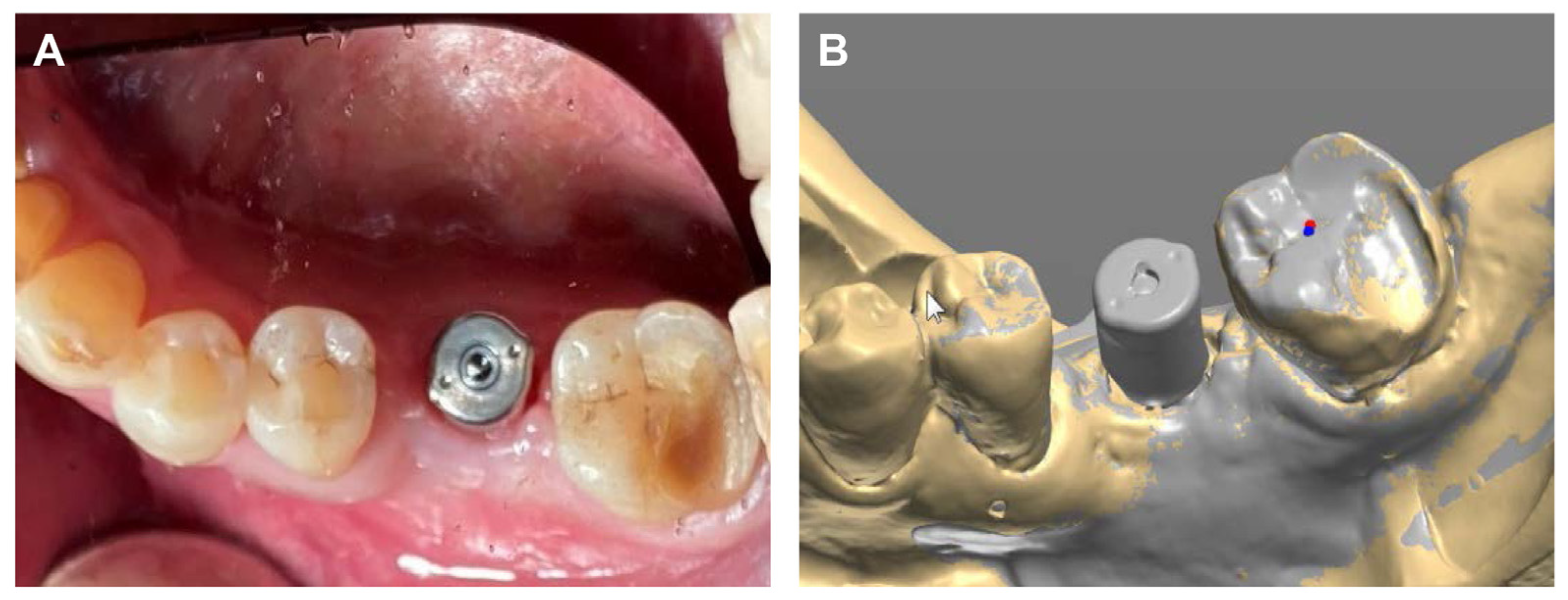 Prosthesis 05 00027 g003