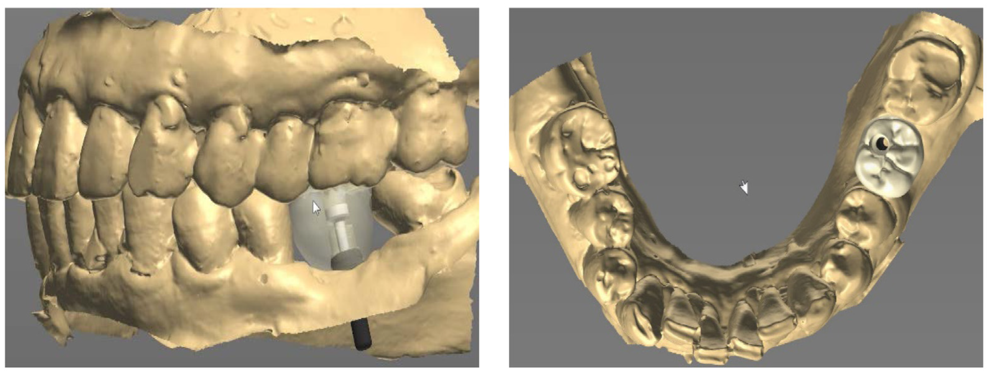 Prosthesis 05 00027 g004