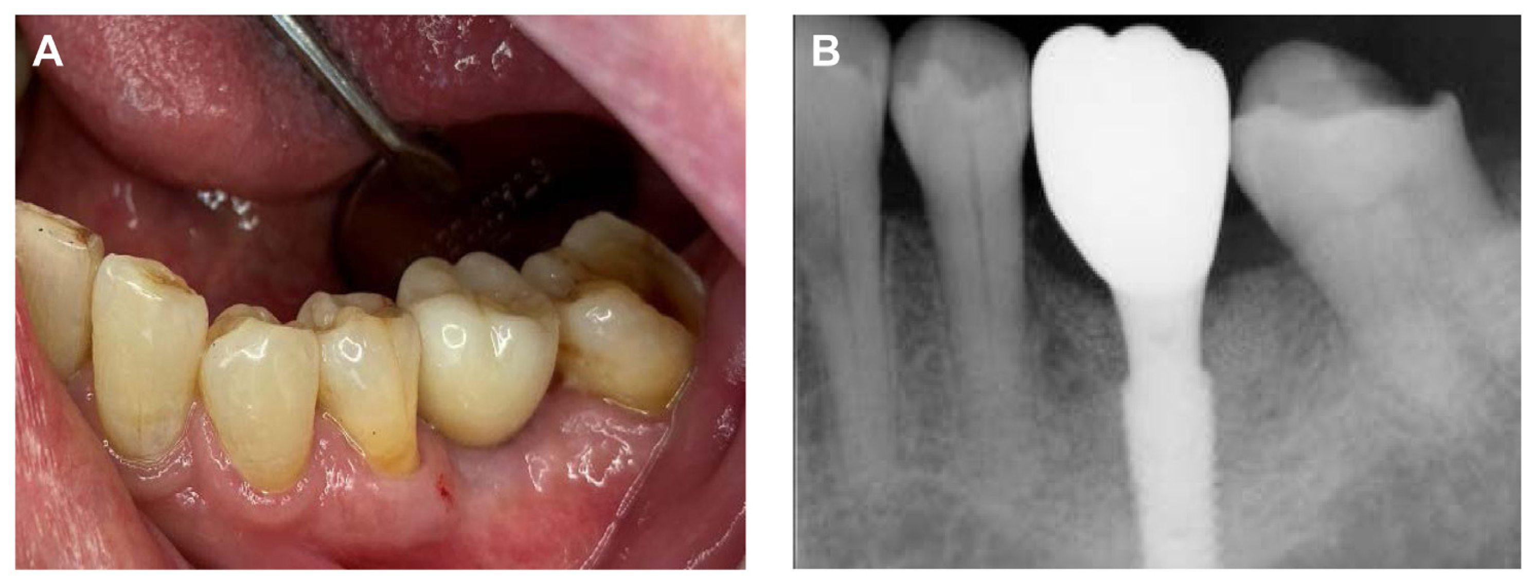 Prosthesis 05 00027 g006