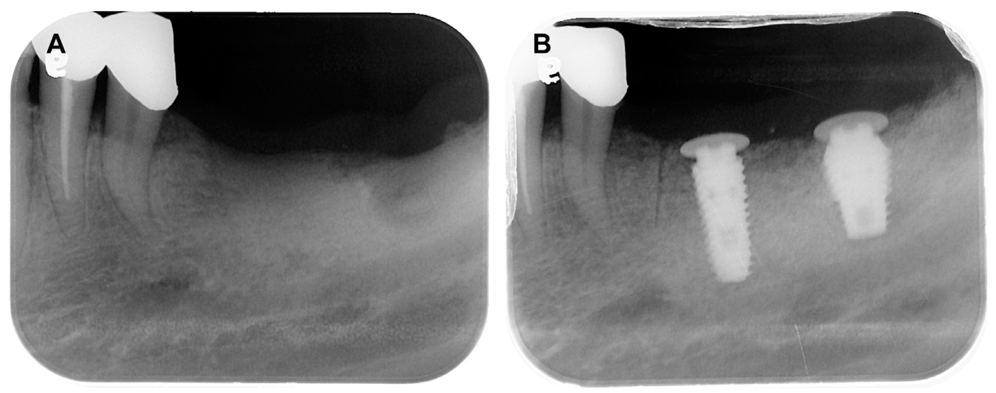 Prosthesis 05 00027 g008