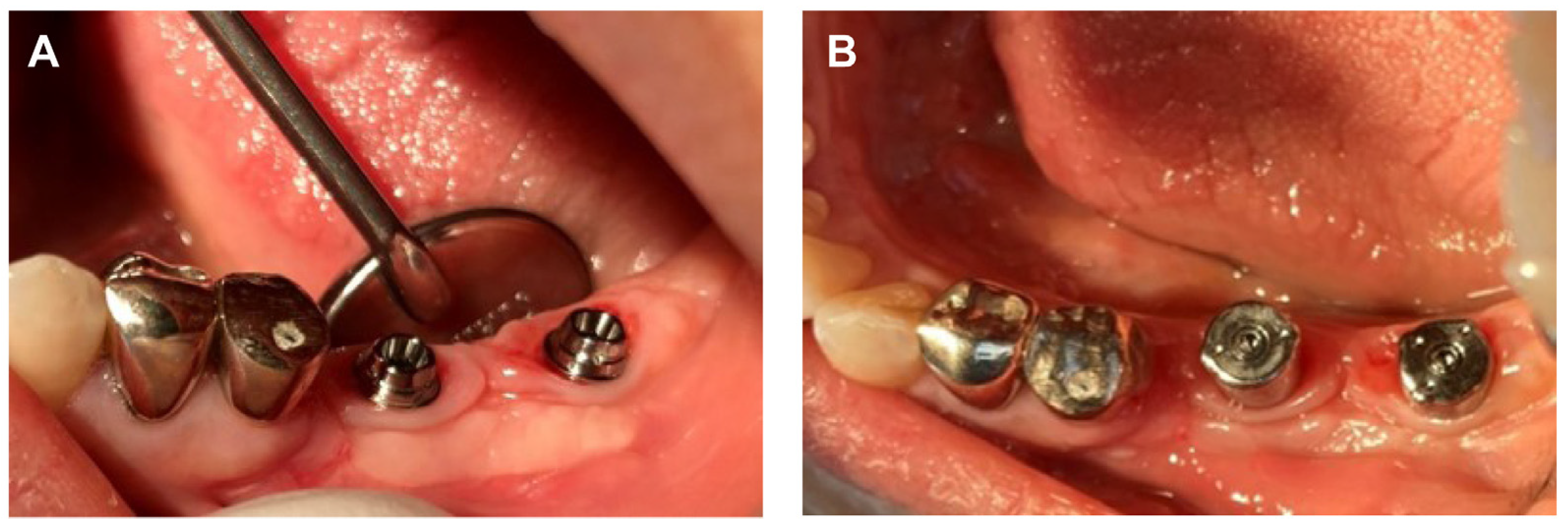 Prosthesis 05 00027 g009