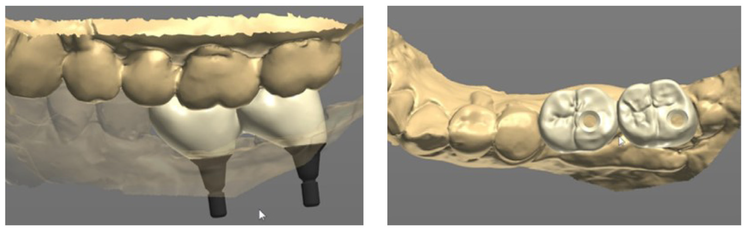 Prosthesis 05 00027 g010