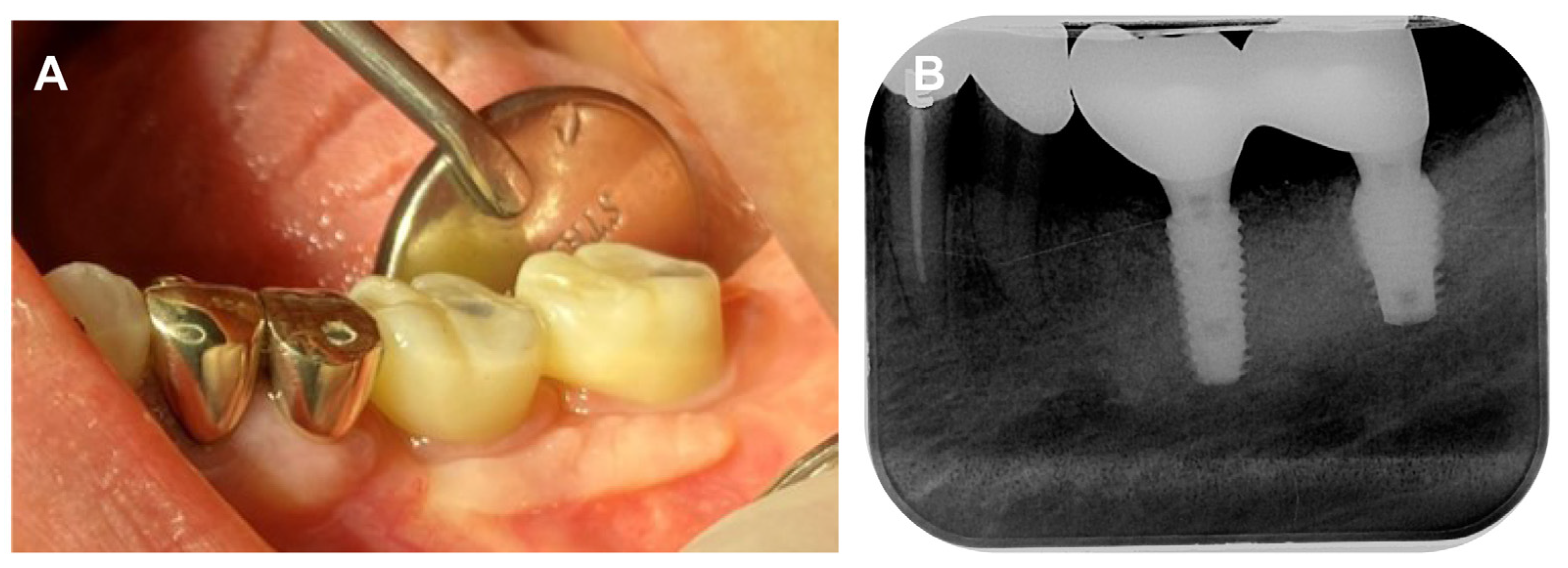 Prosthesis 05 00027 g011
