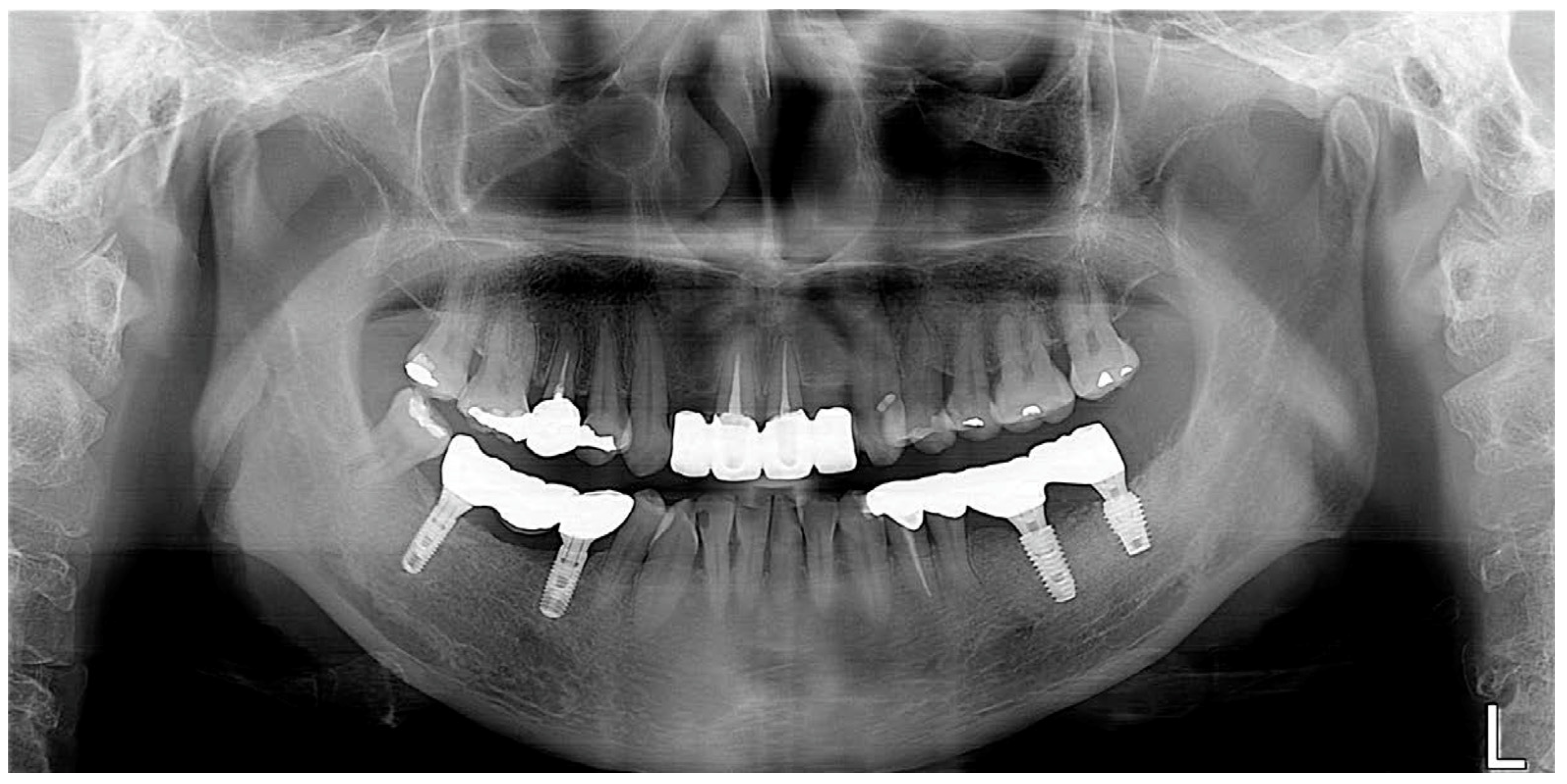 Prosthesis 05 00027 g012