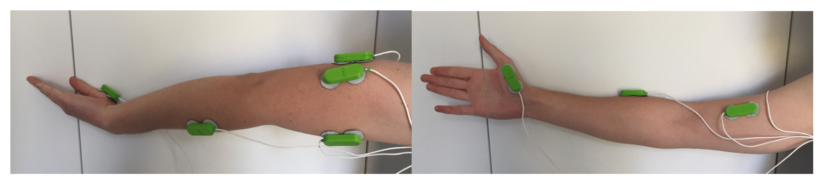 Prosthesis 05 00031 g002