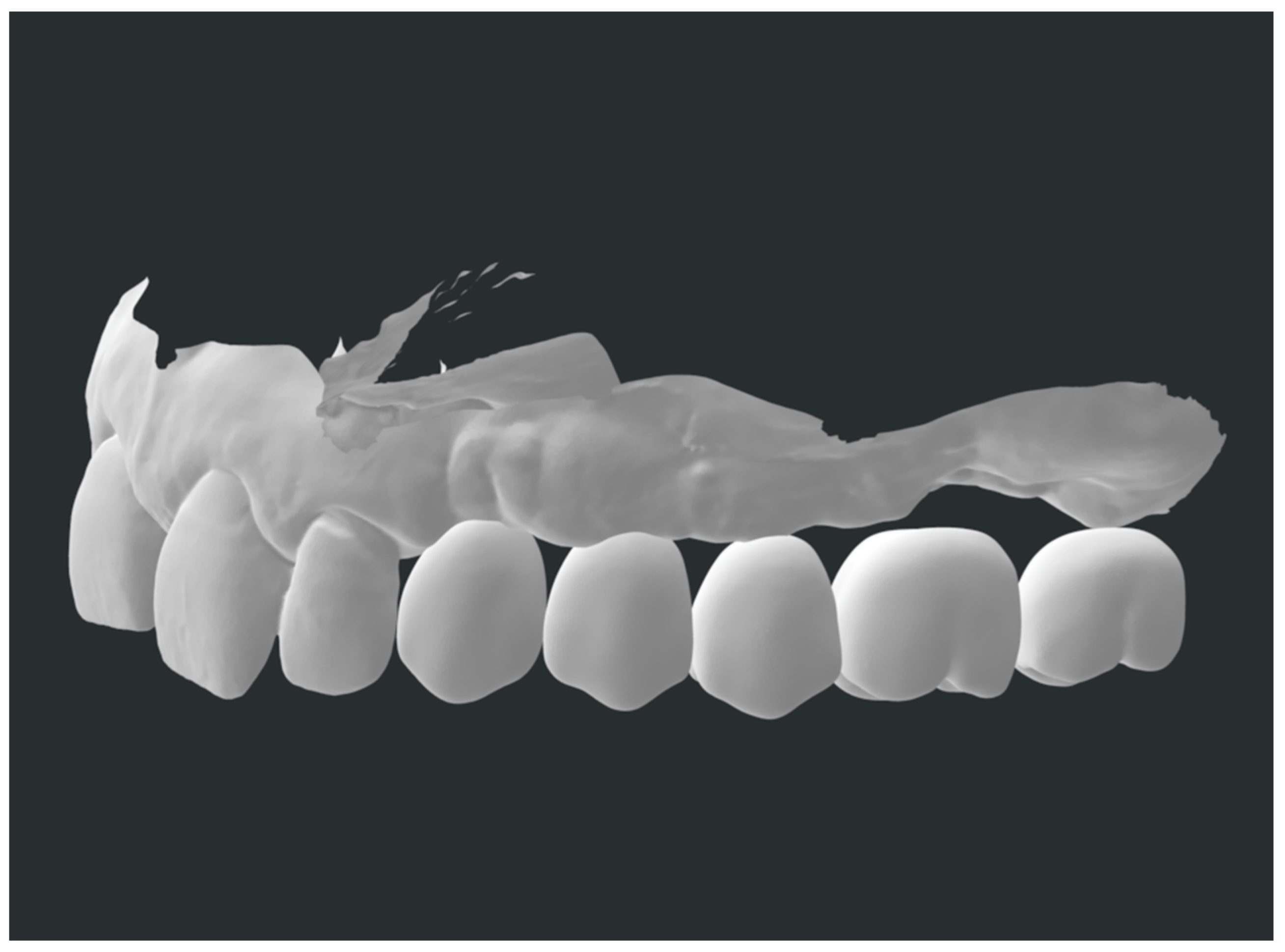 Prosthesis 05 00033 g004