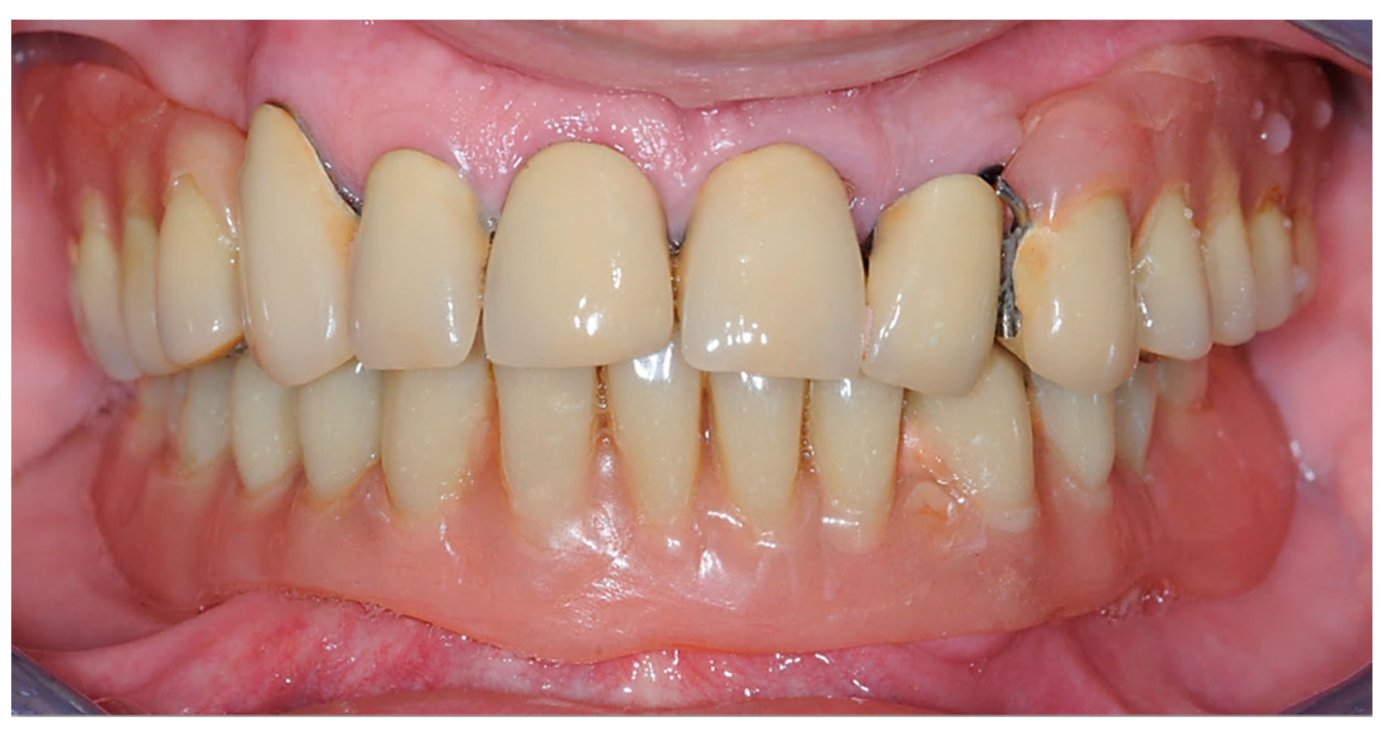 Prosthesis 05 00034 g001