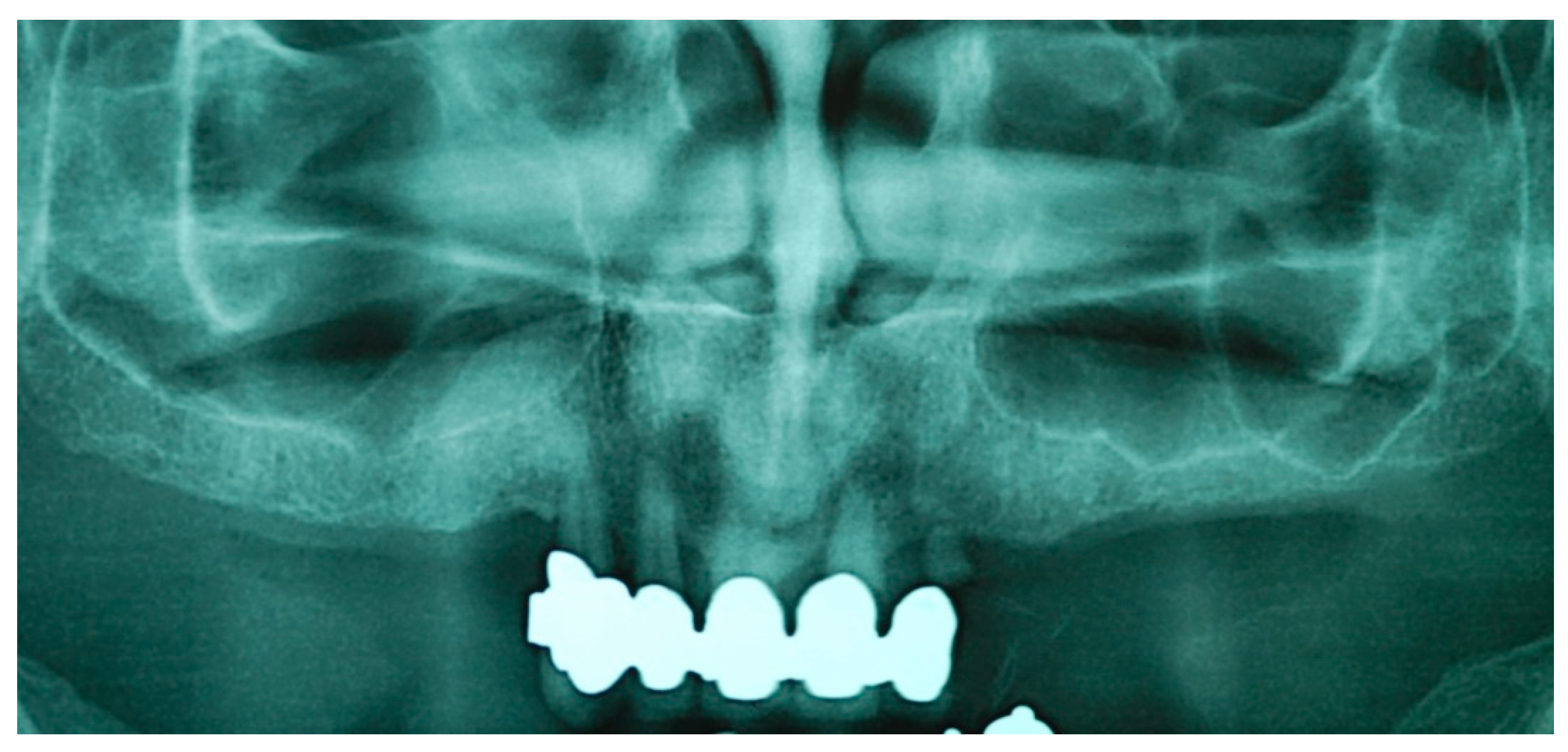 Prosthesis 05 00034 g002