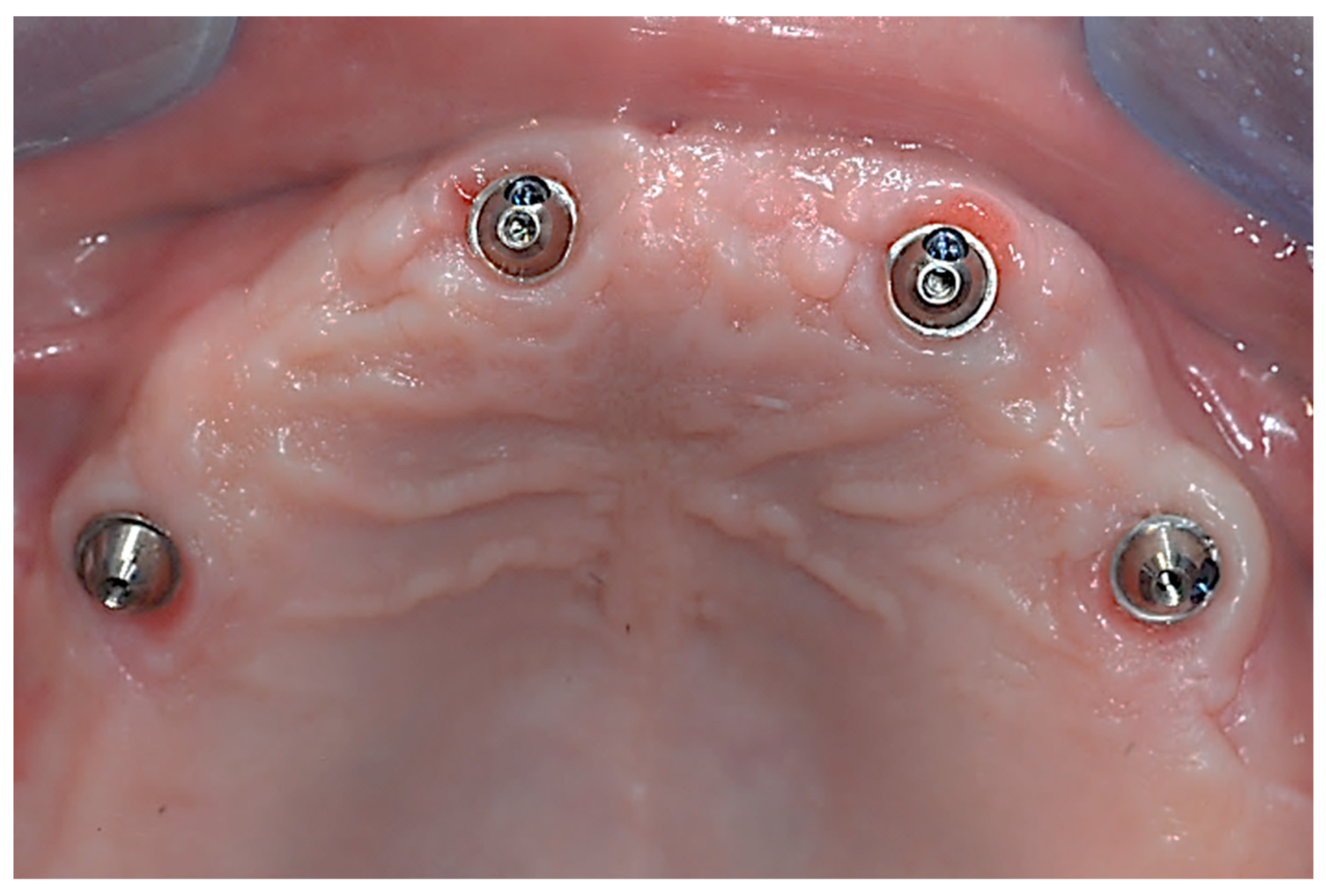 Prosthesis 05 00034 g003