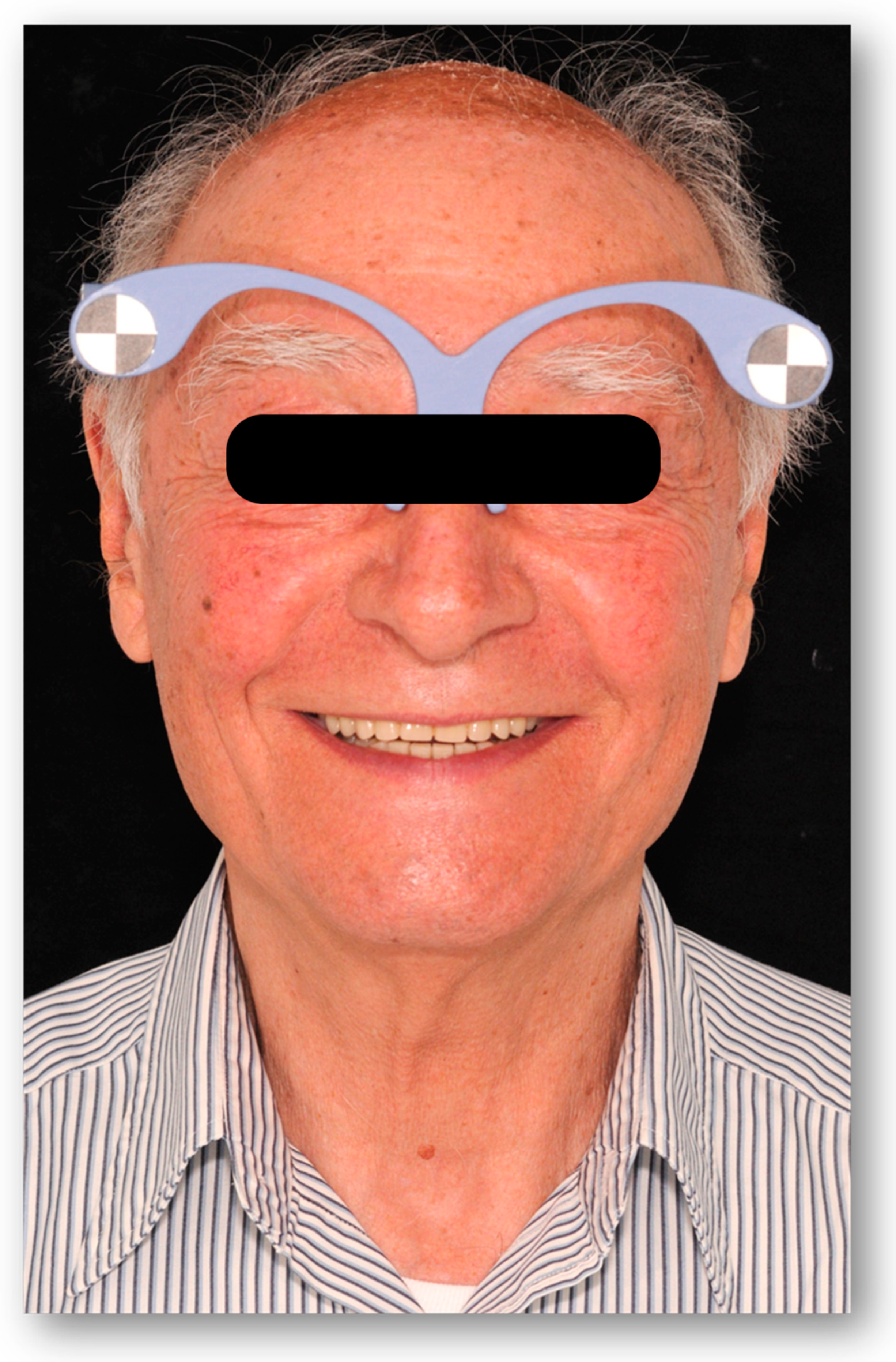 Prosthesis 05 00034 g005