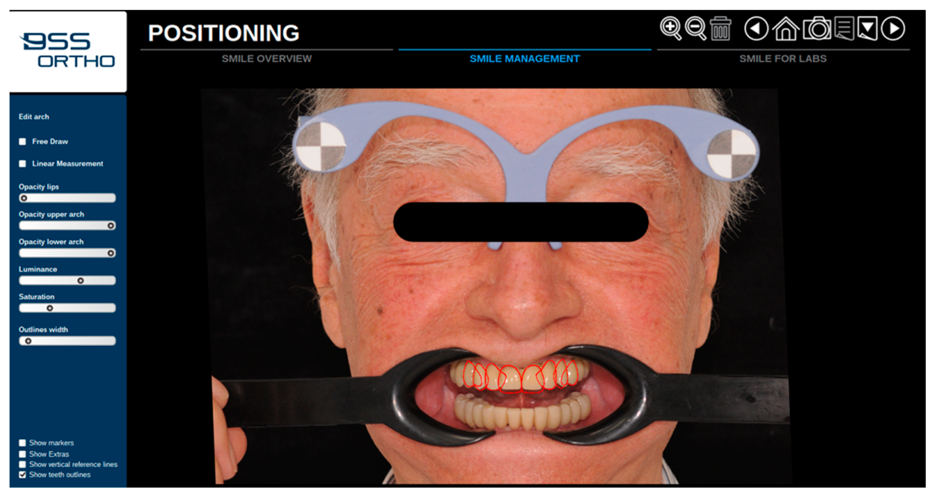 Prosthesis 05 00034 g006