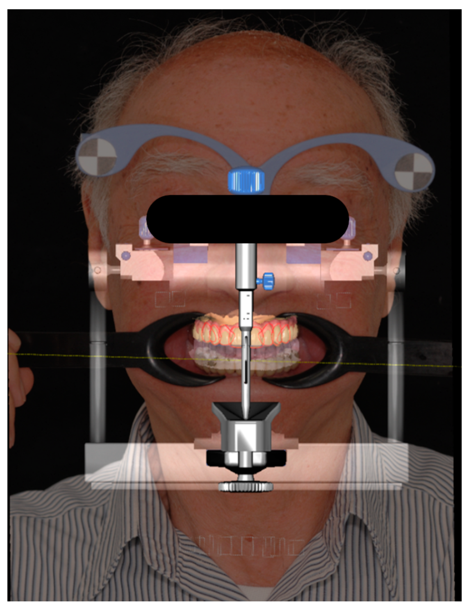 Prosthesis 05 00034 g007