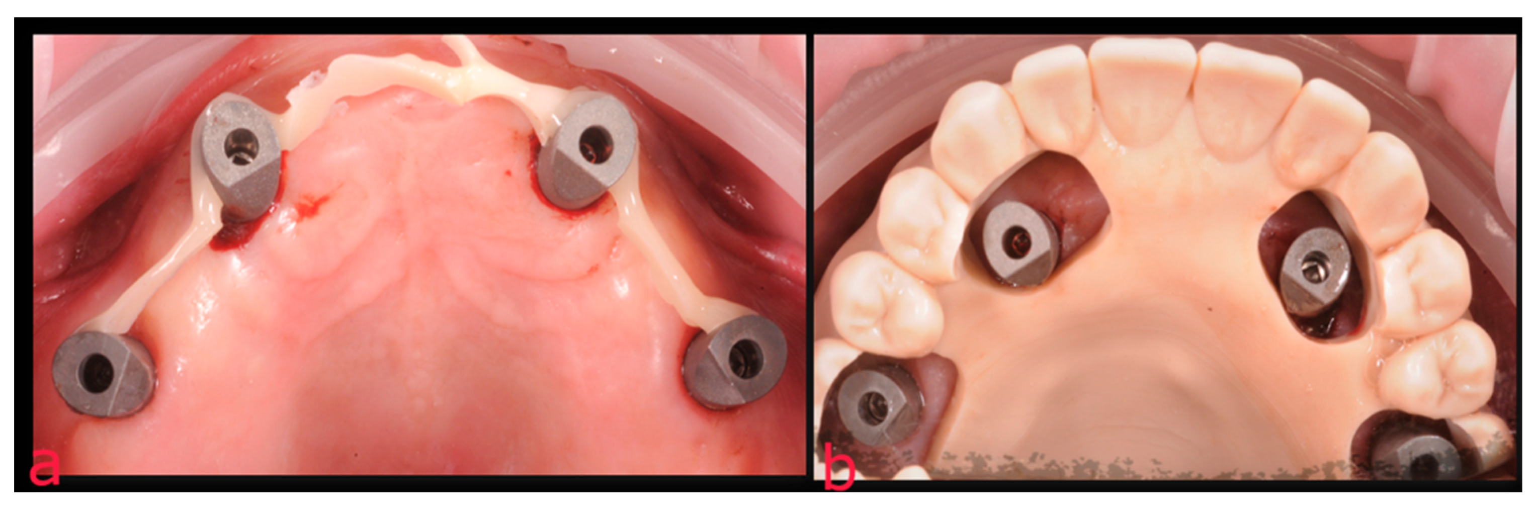 Prosthesis 05 00034 g008