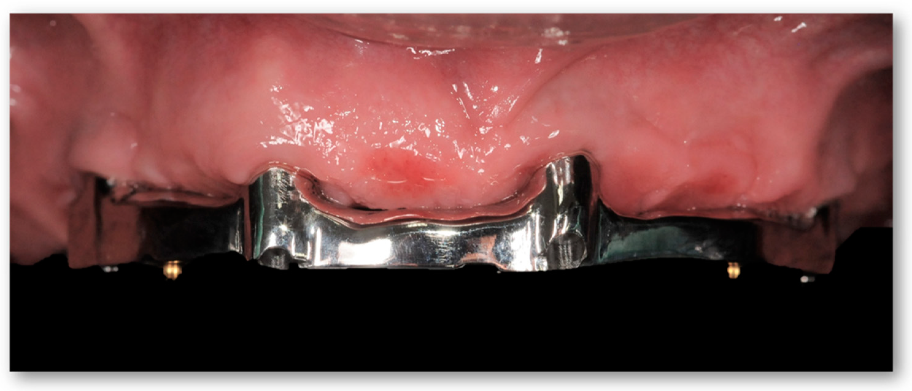 Prosthesis 05 00034 g011