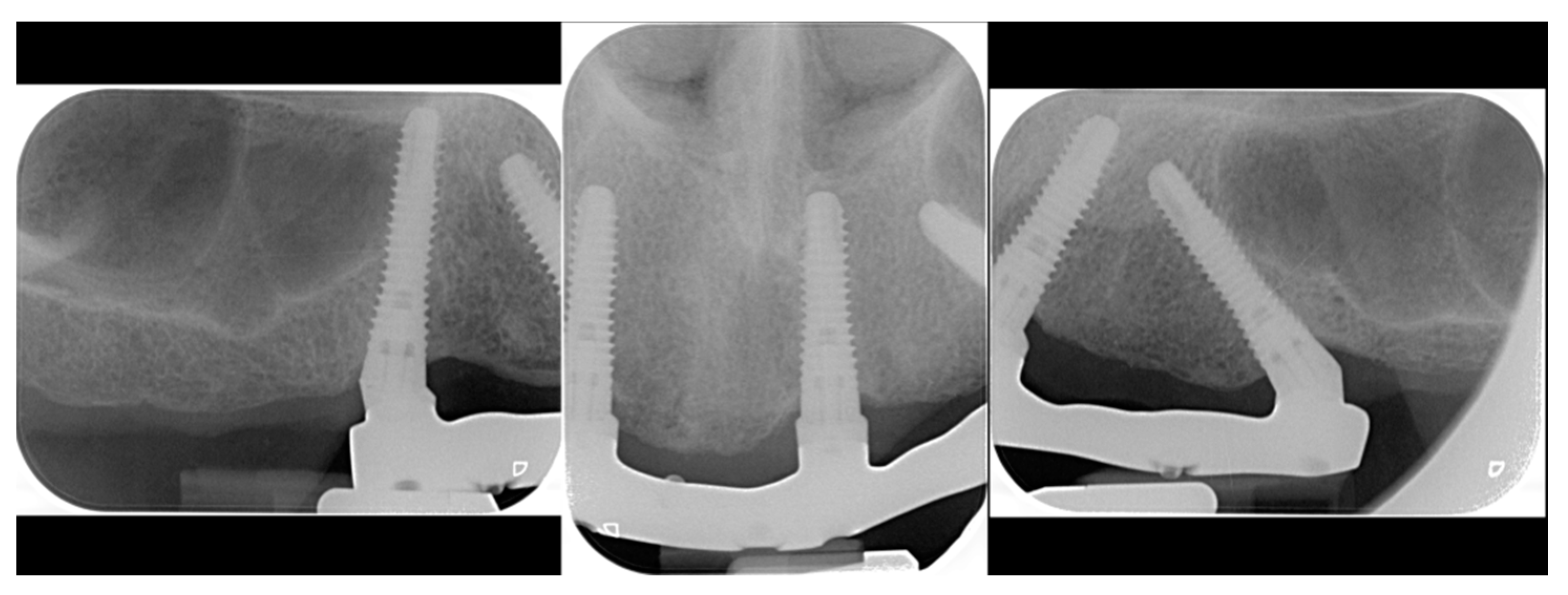 Prosthesis 05 00034 g012