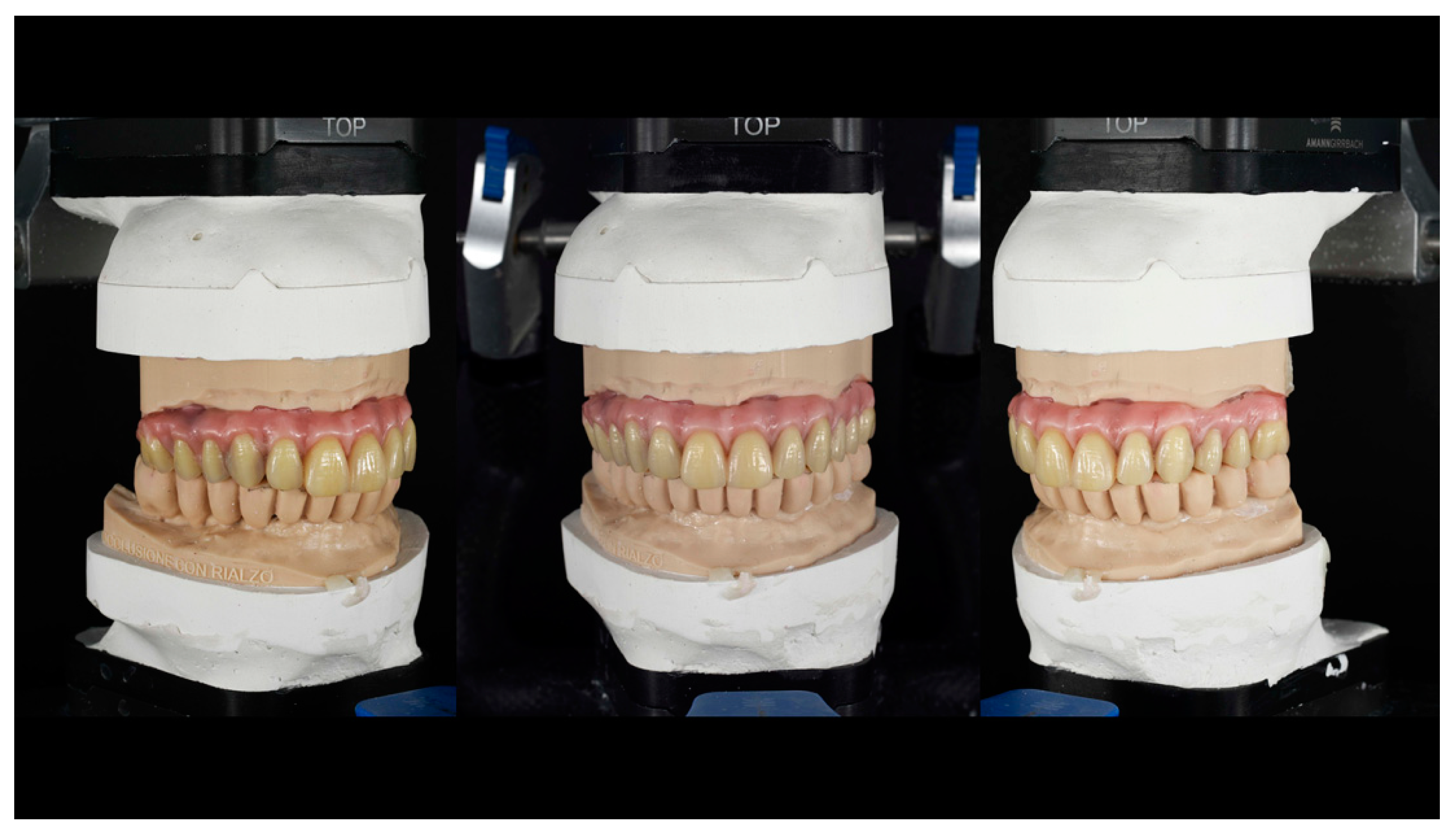 Prosthesis 05 00034 g014