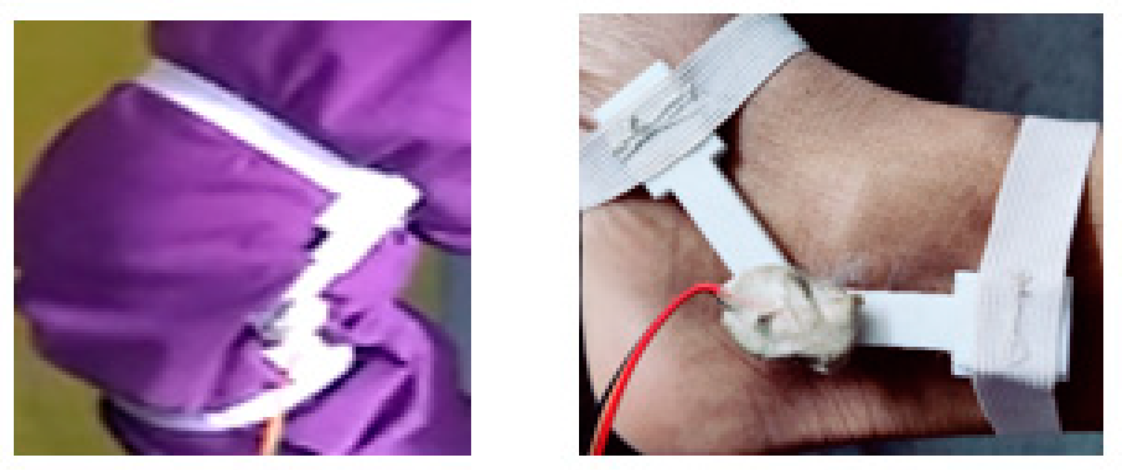 Prosthesis 05 00040 g002 Prosthesis 05 00040 g002