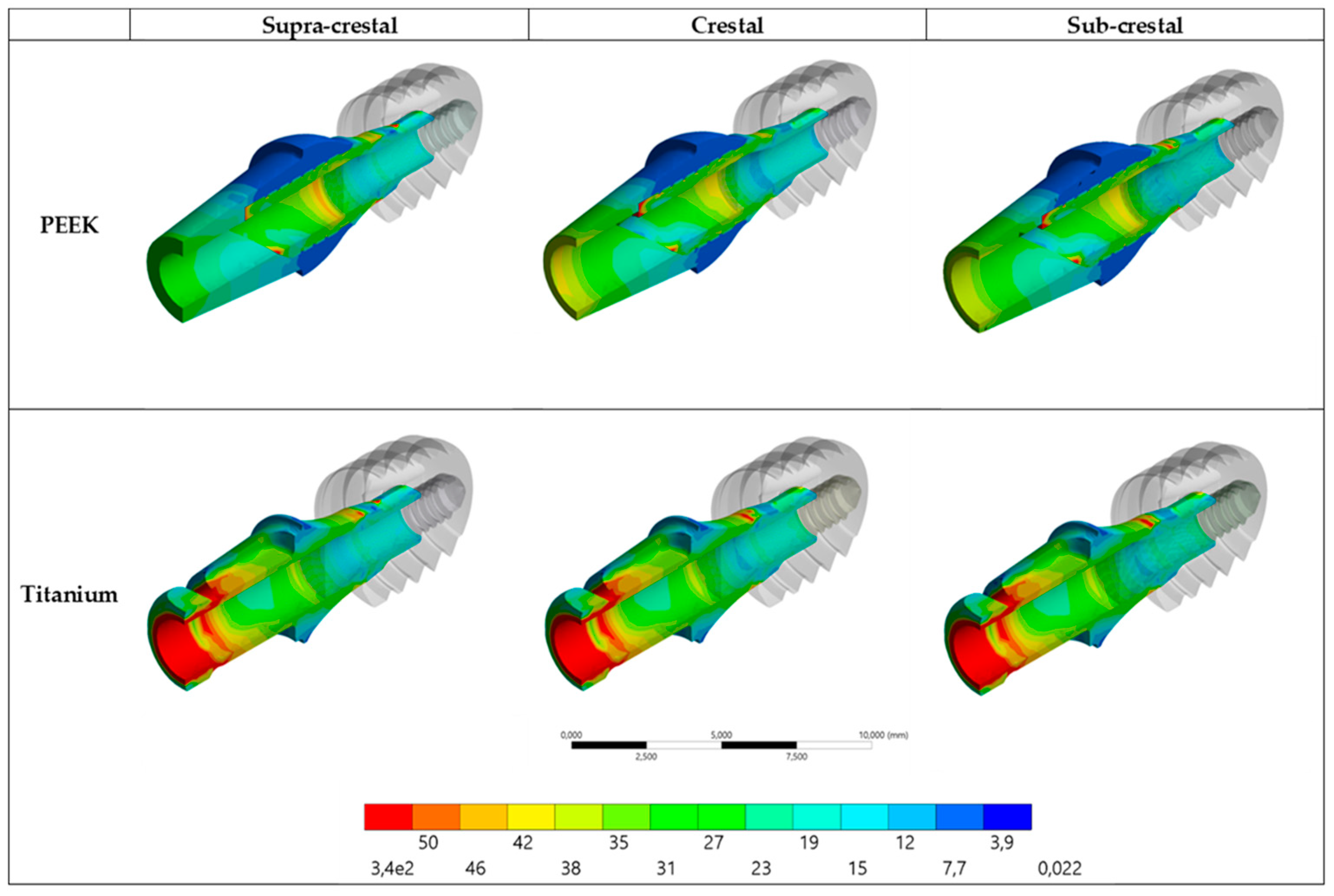 Prosthesis 05 00051 g005 Prosthesis 05 00051 g005