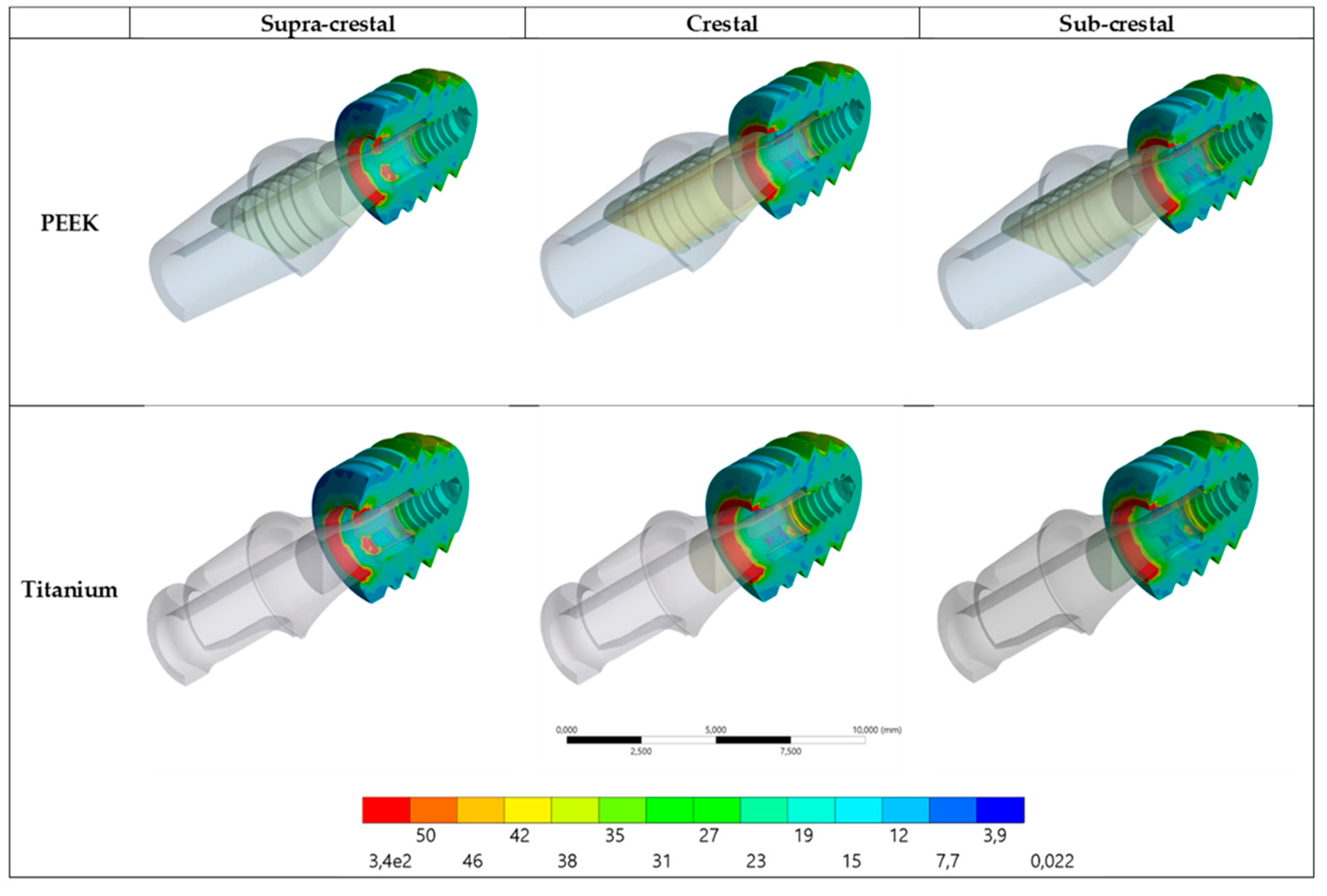 Prosthesis 05 00051 g007 Prosthesis 05 00051 g007