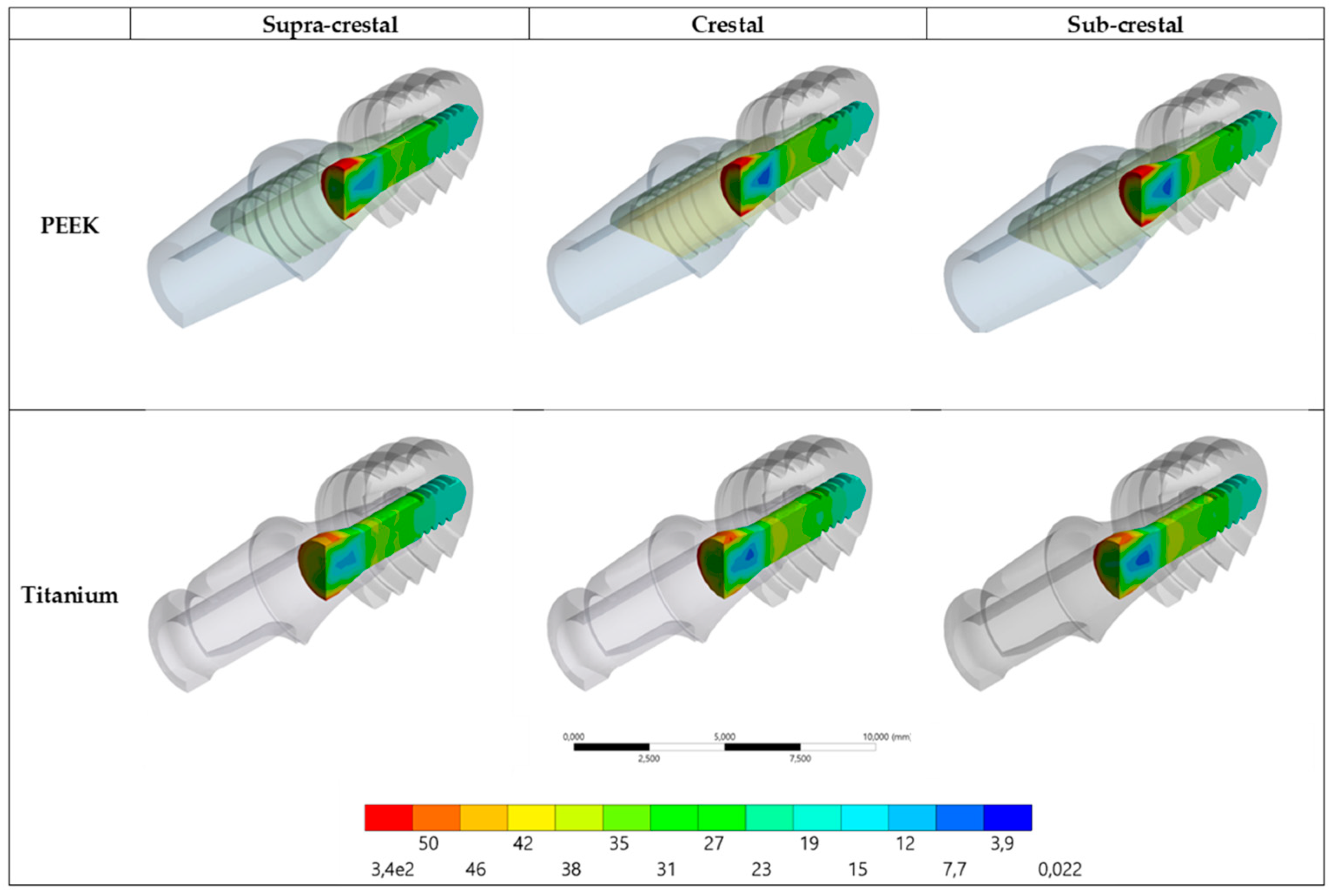 Prosthesis 05 00051 g008 Prosthesis 05 00051 g008
