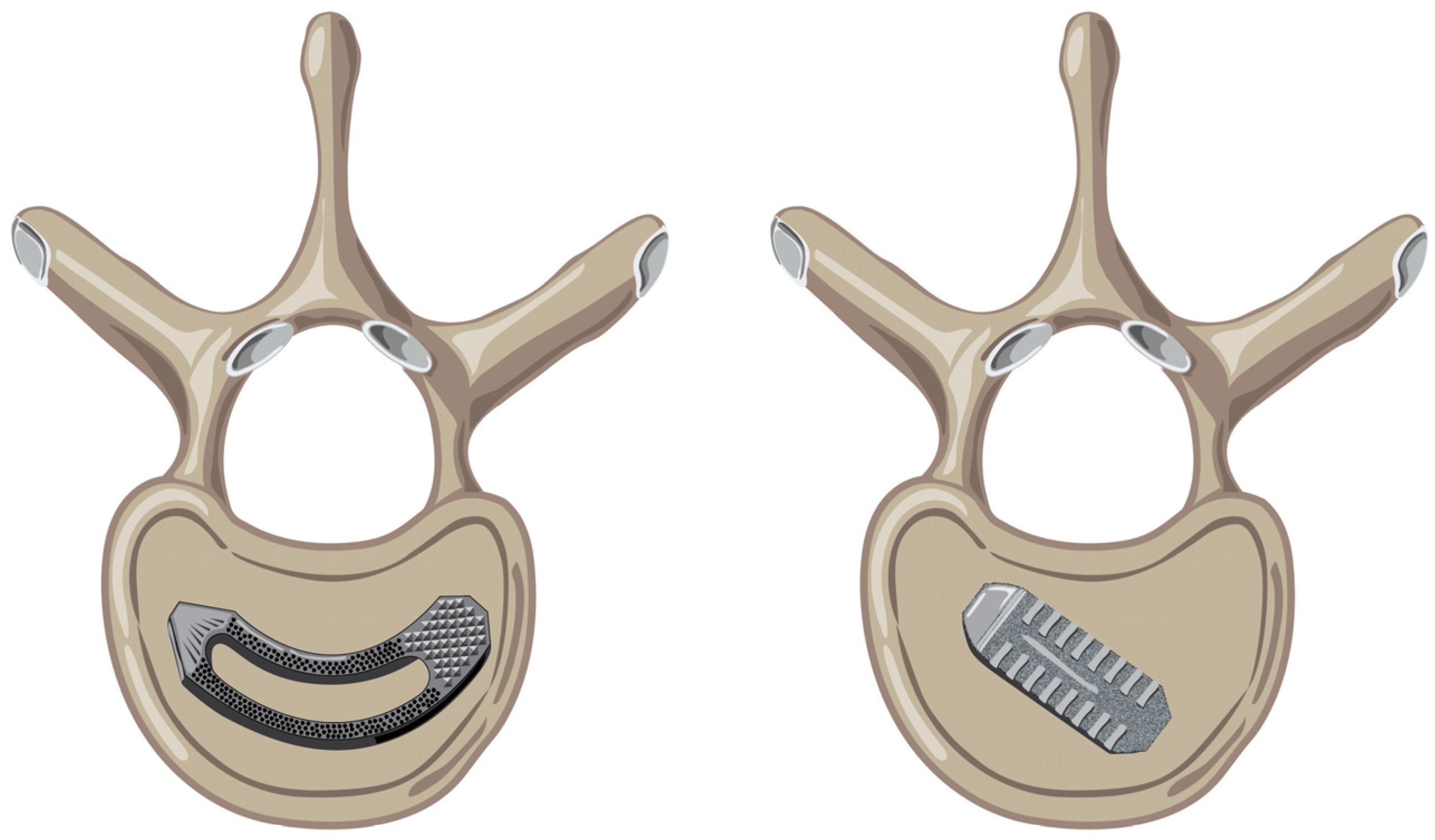 Prosthesis 05 00053 g001 Prosthesis 05 00053 g001