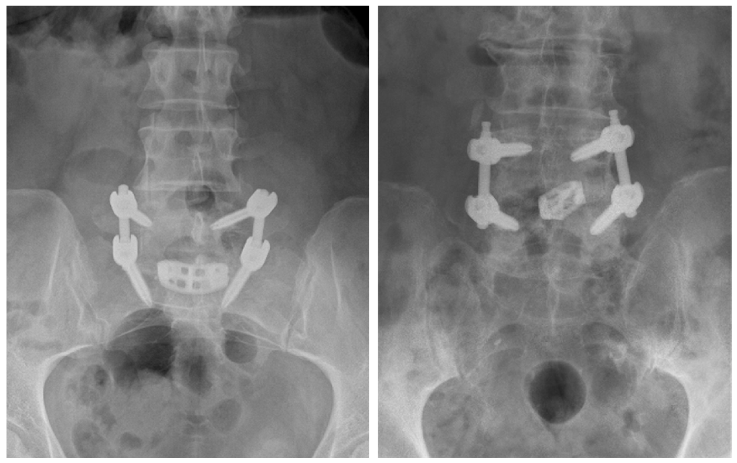 Prosthesis 05 00053 g002 Prosthesis 05 00053 g002