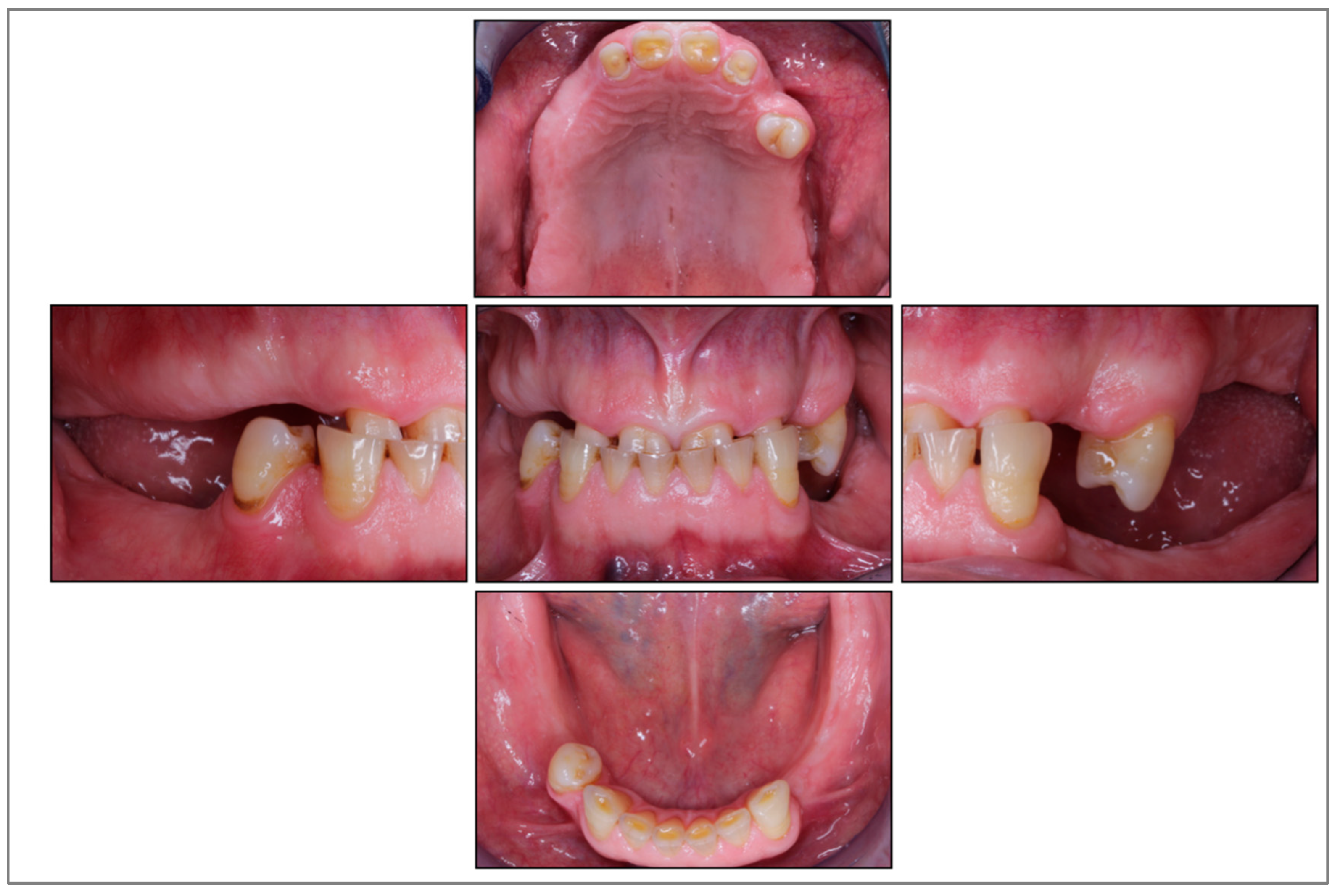 Prosthesis 05 00069 g001