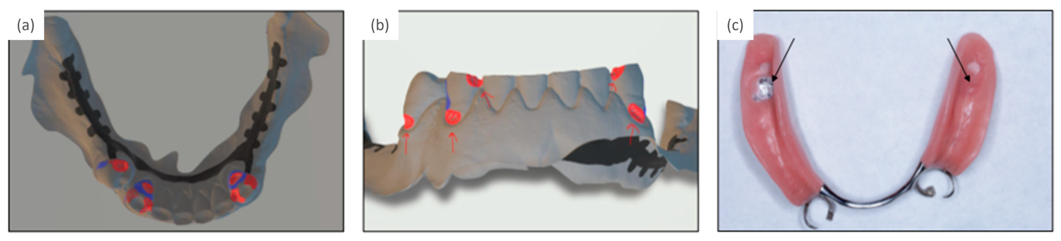 Prosthesis 05 00069 g002