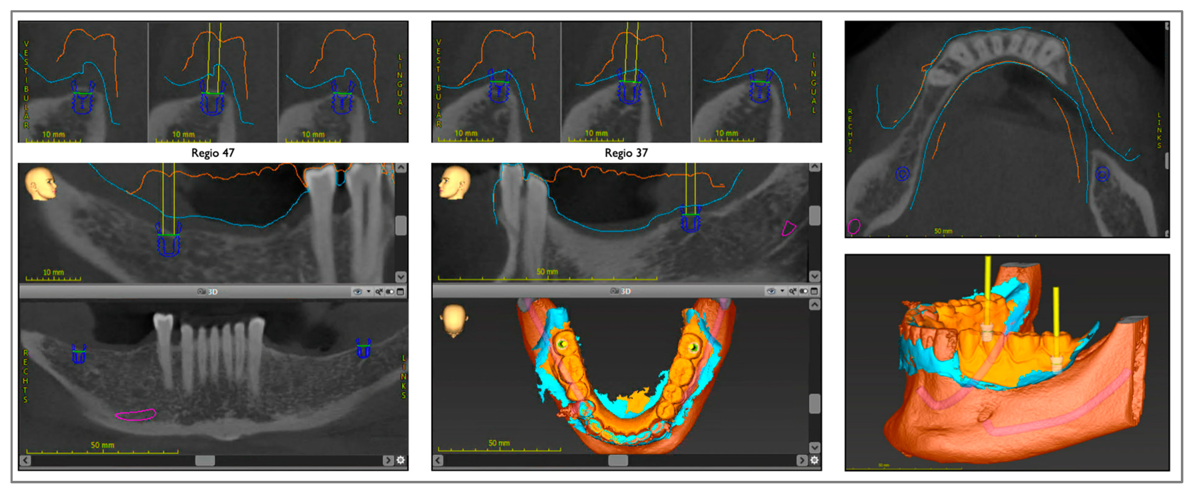 Prosthesis 05 00069 g003