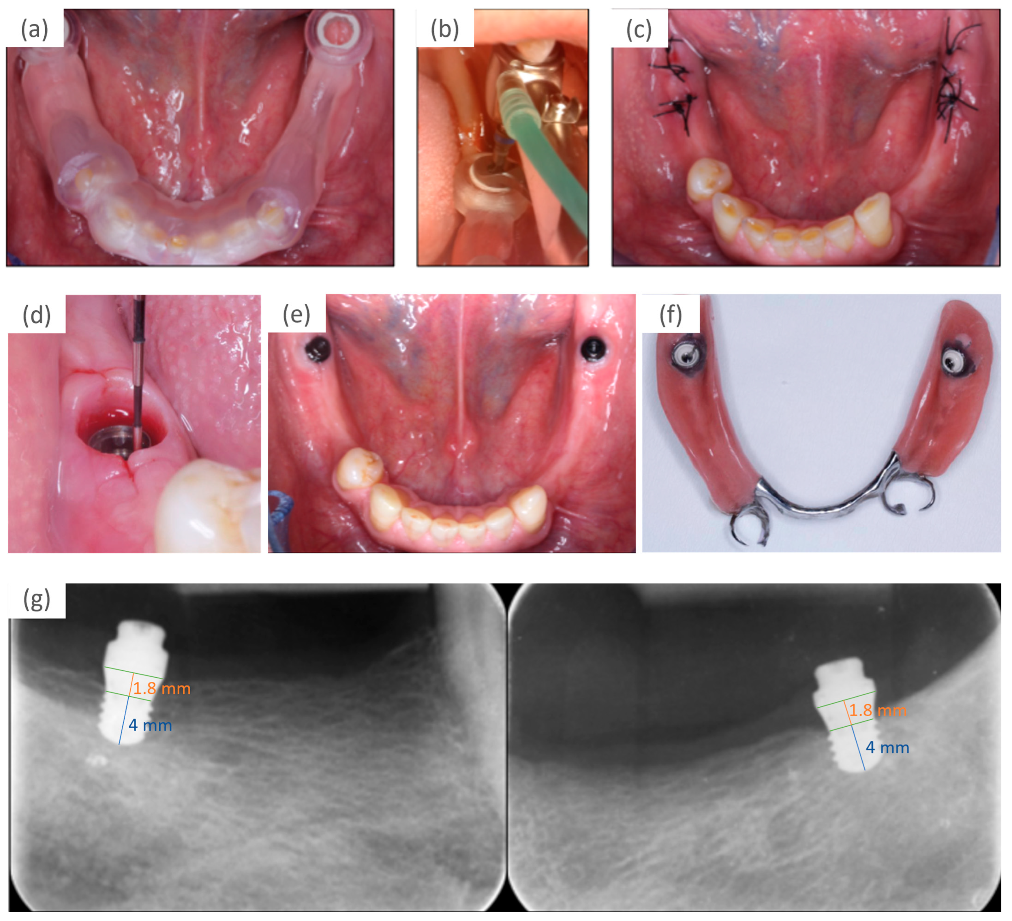 Prosthesis 05 00069 g004