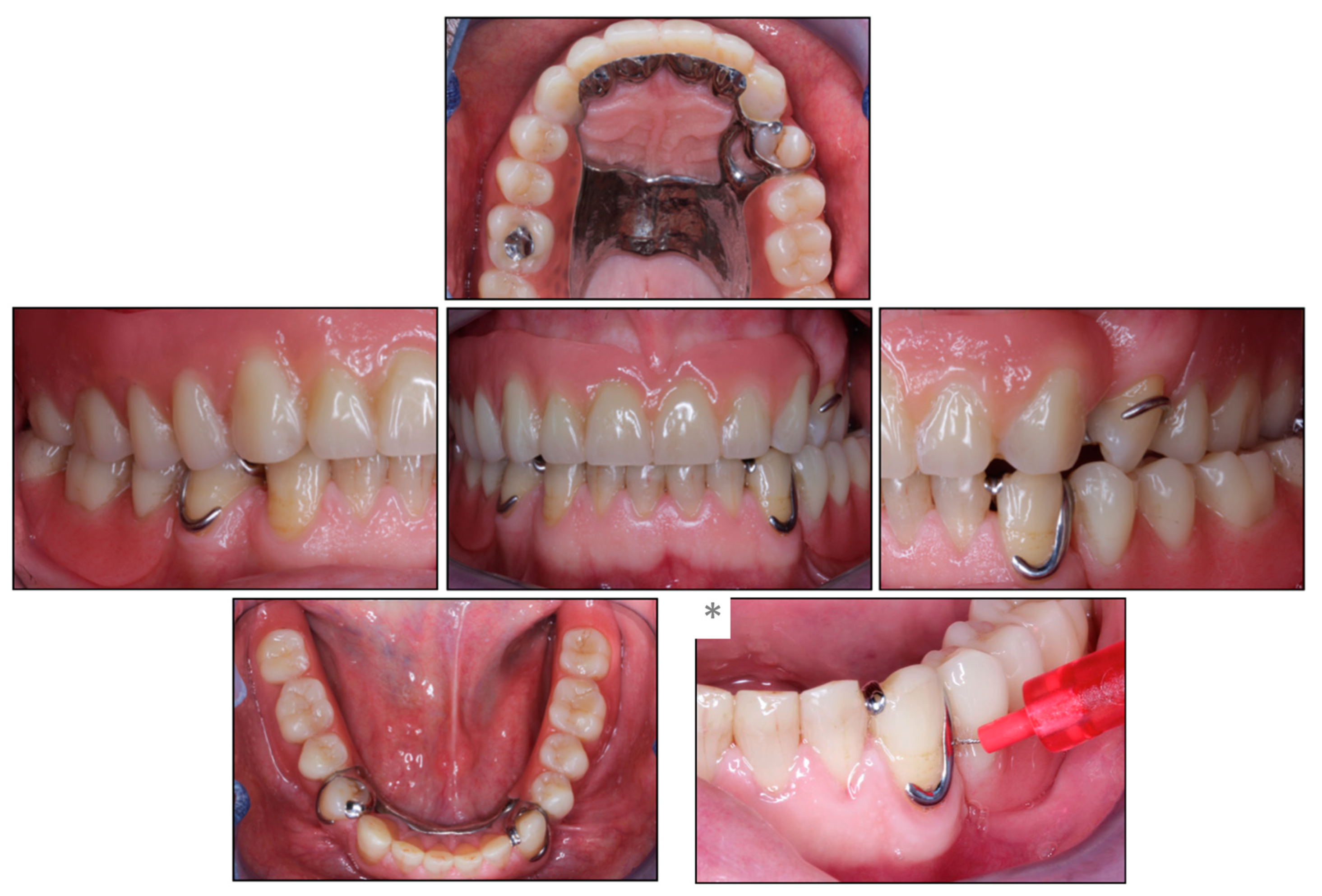 Prosthesis 05 00069 g005
