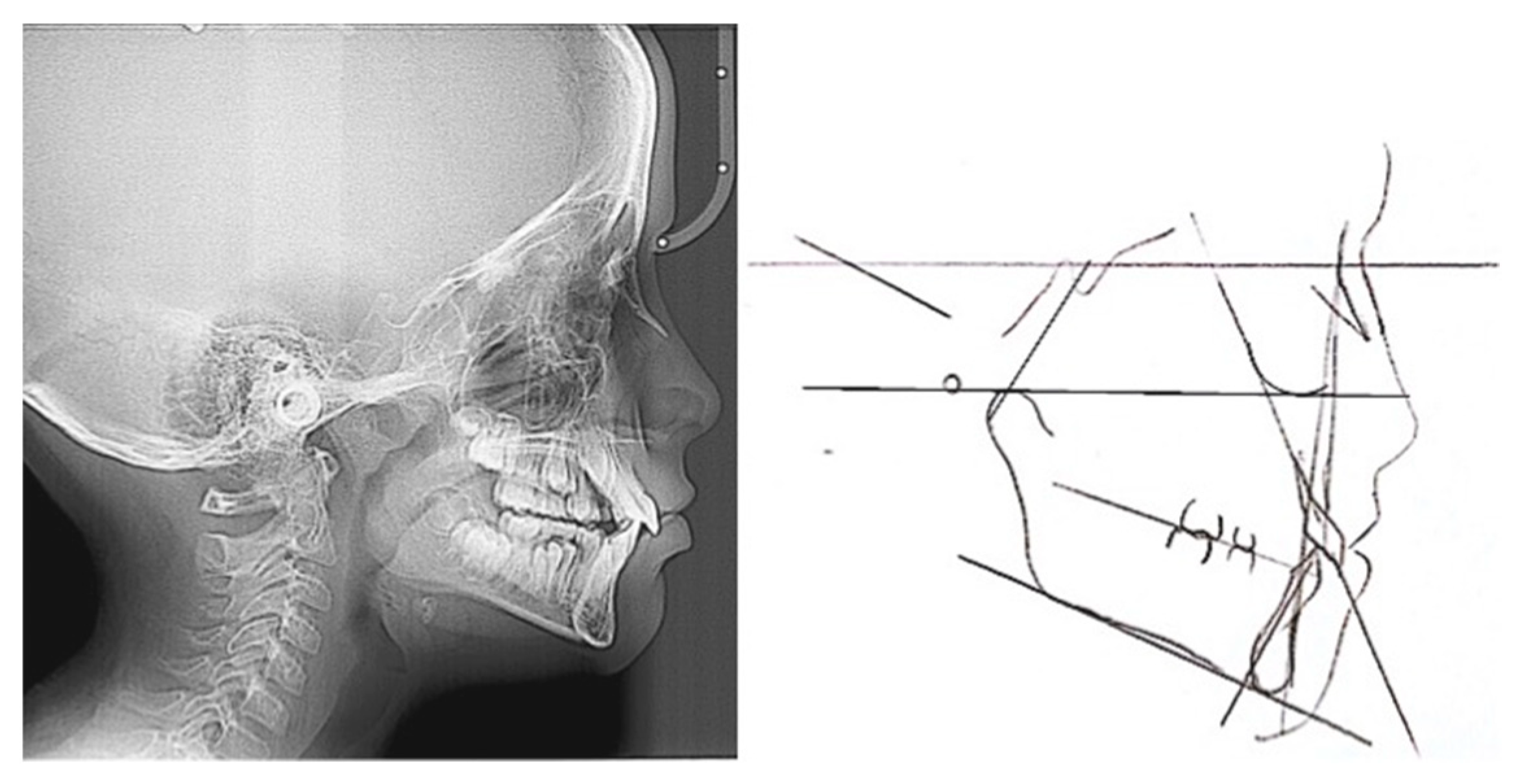 Prosthesis 05 00073 g002