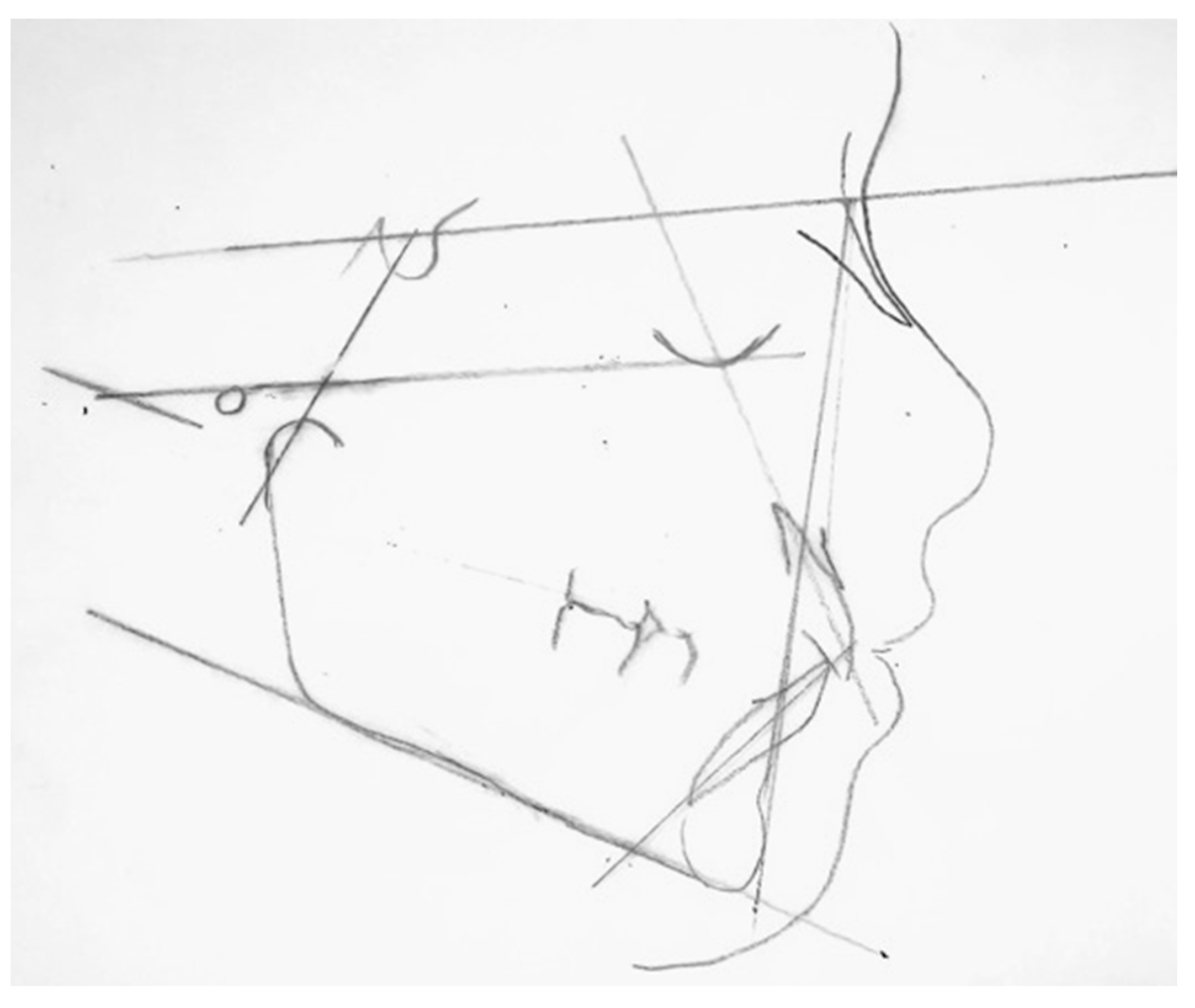 Prosthesis 05 00073 g006