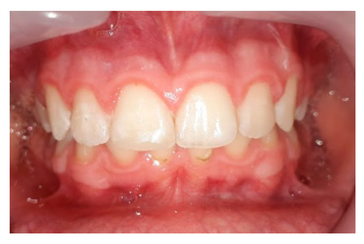 Prosthesis 05 00073 g009