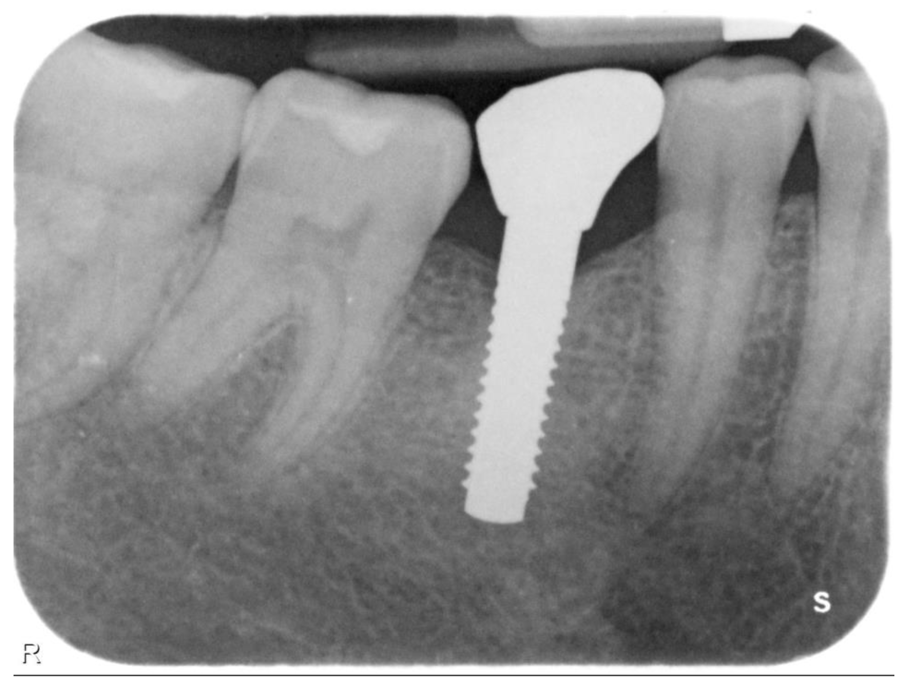 Prosthesis 05 00074 g003