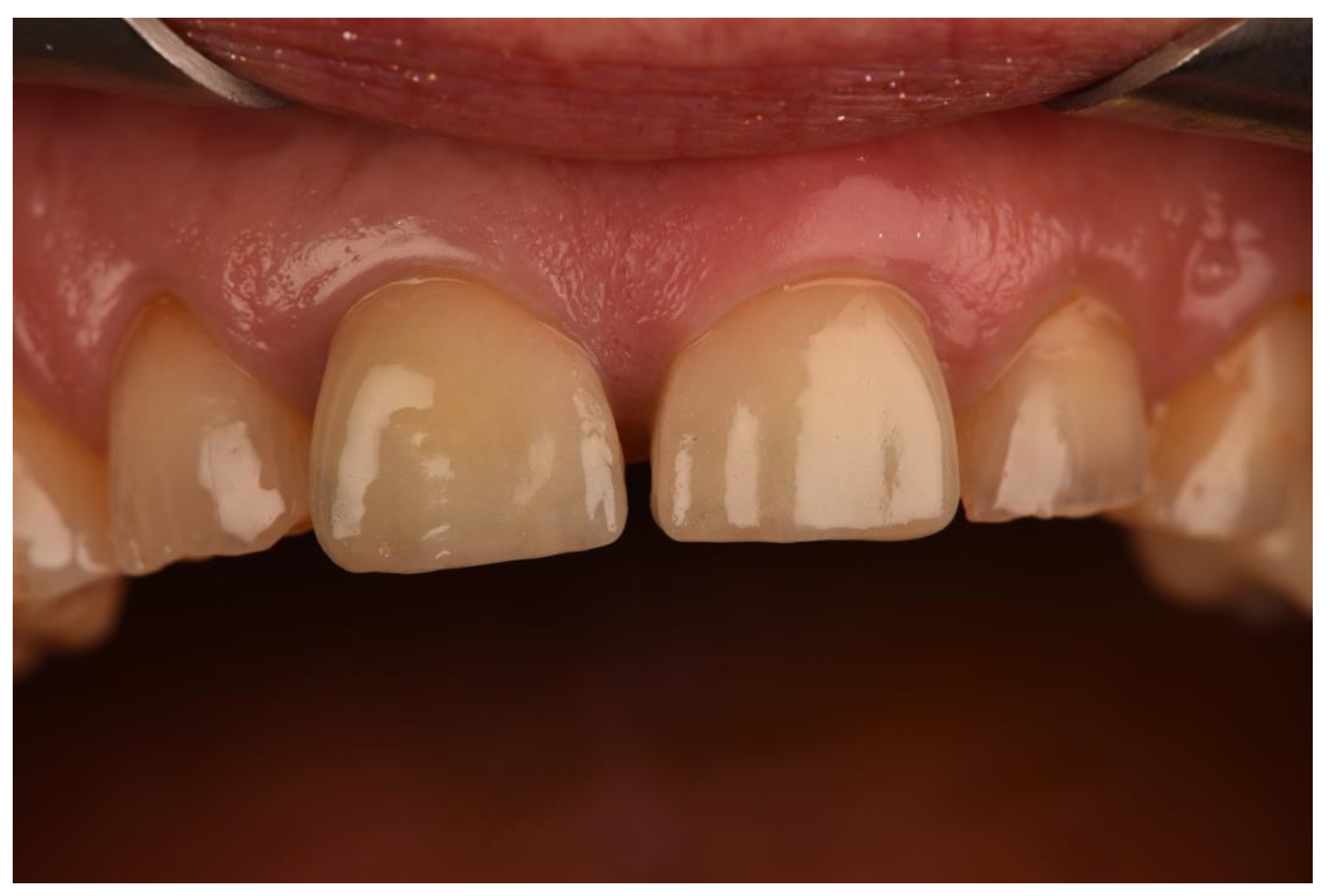 Prosthesis 05 00074 g004