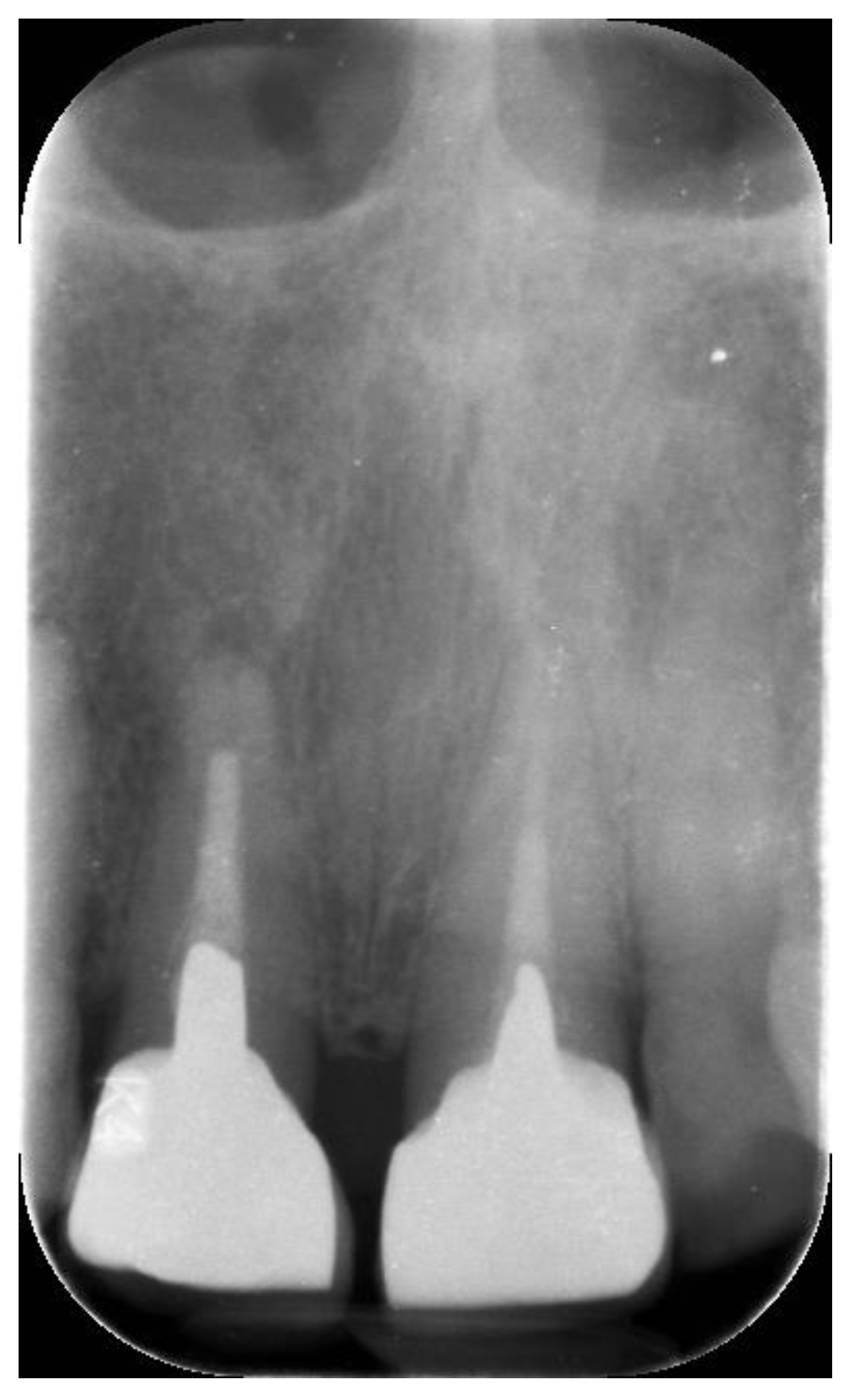 Prosthesis 05 00074 g006