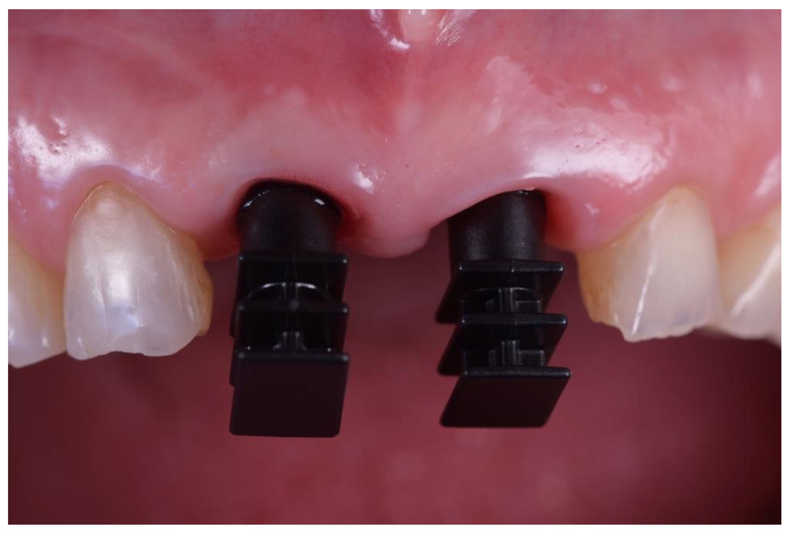 Prosthesis 05 00074 g008