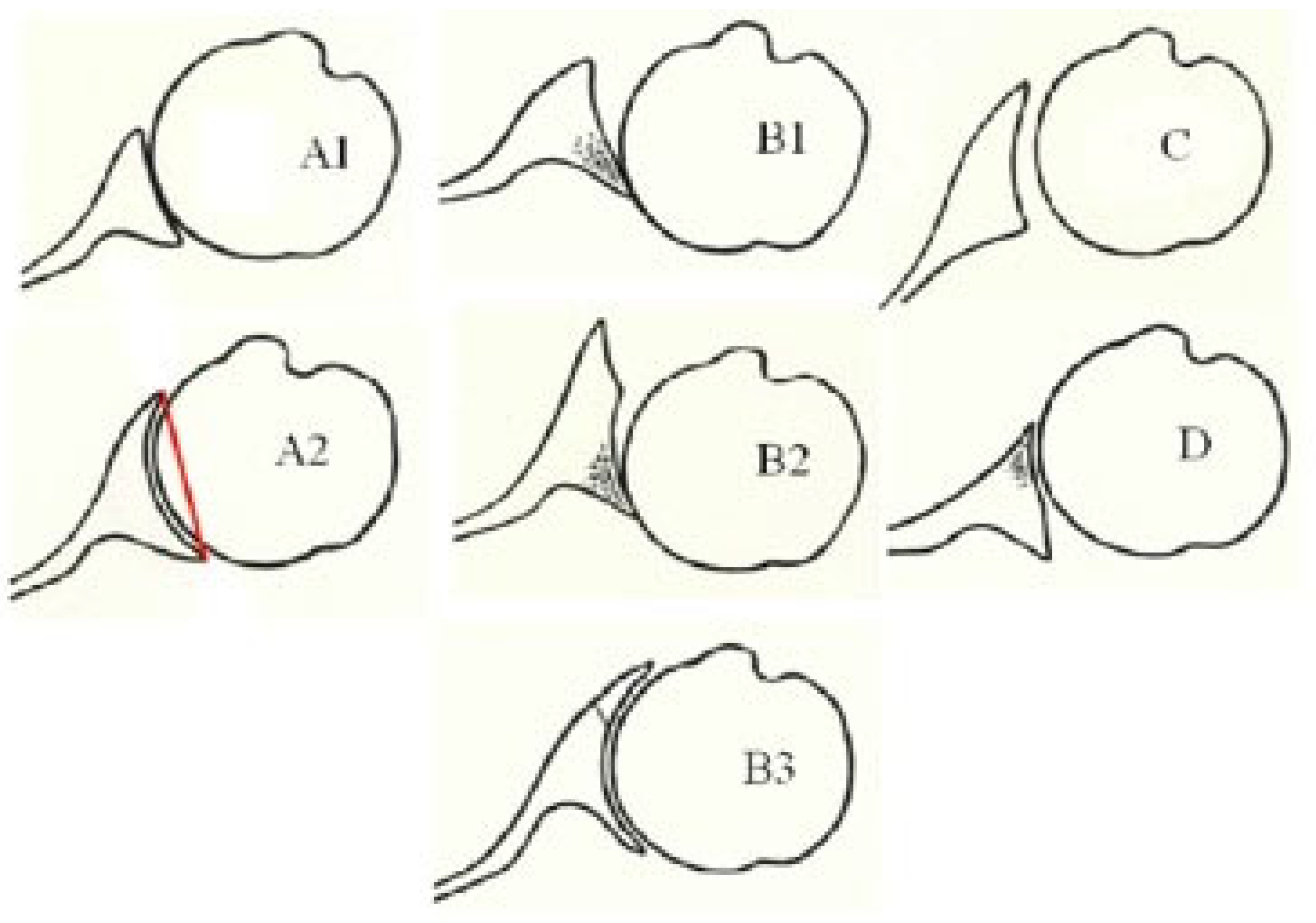Prosthesis 05 00075 g001
