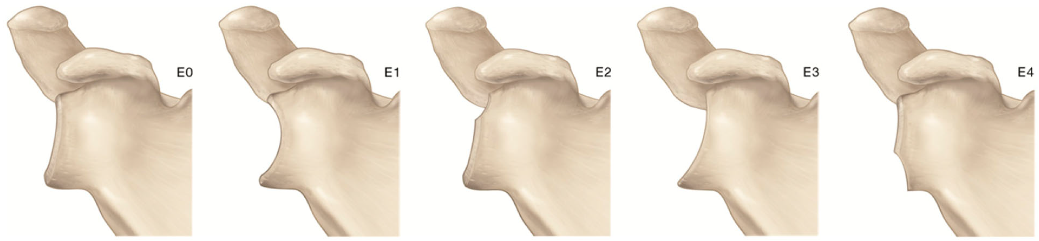 Prosthesis 05 00075 g003