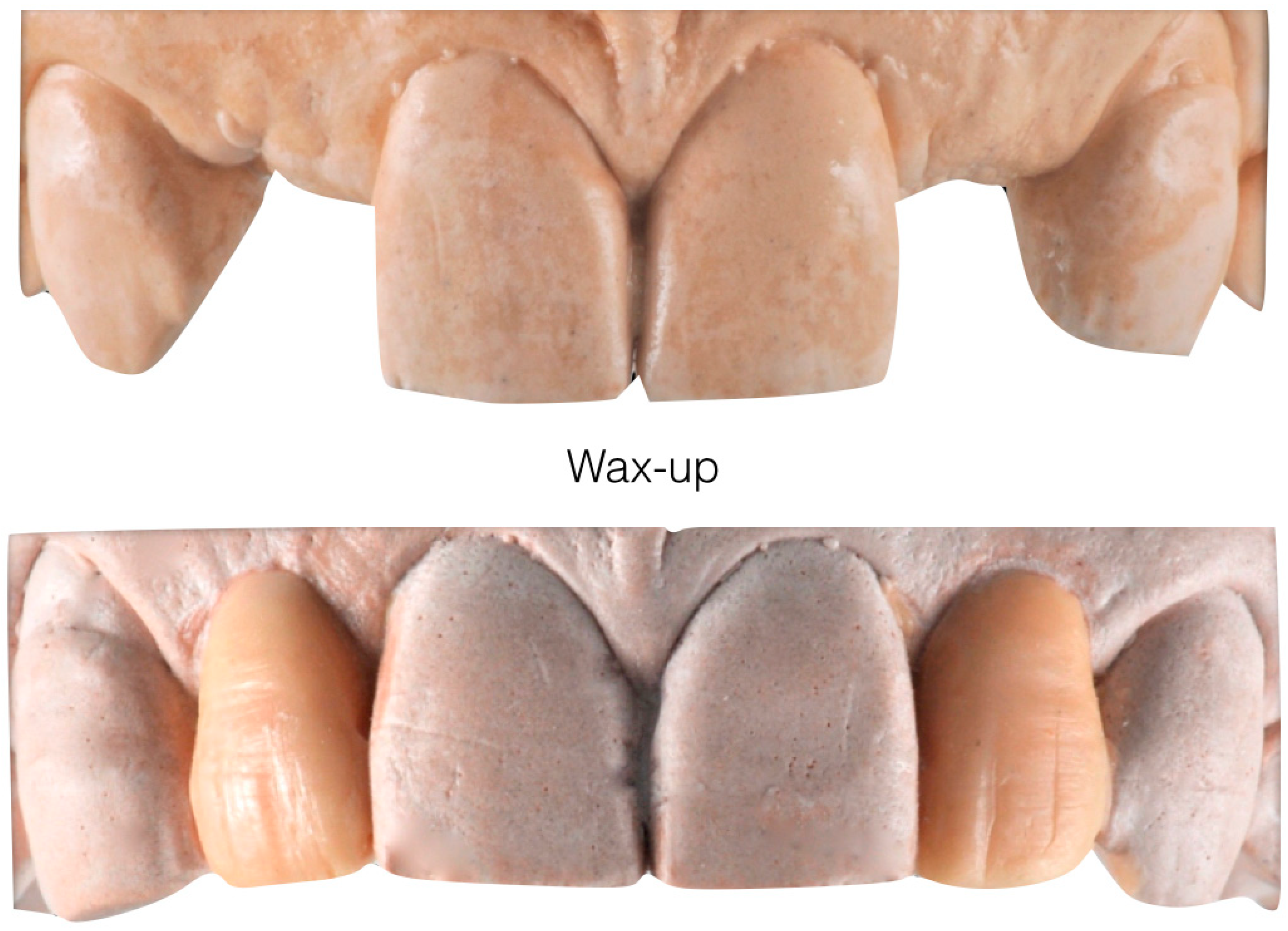 Prosthesis 05 00081 g003