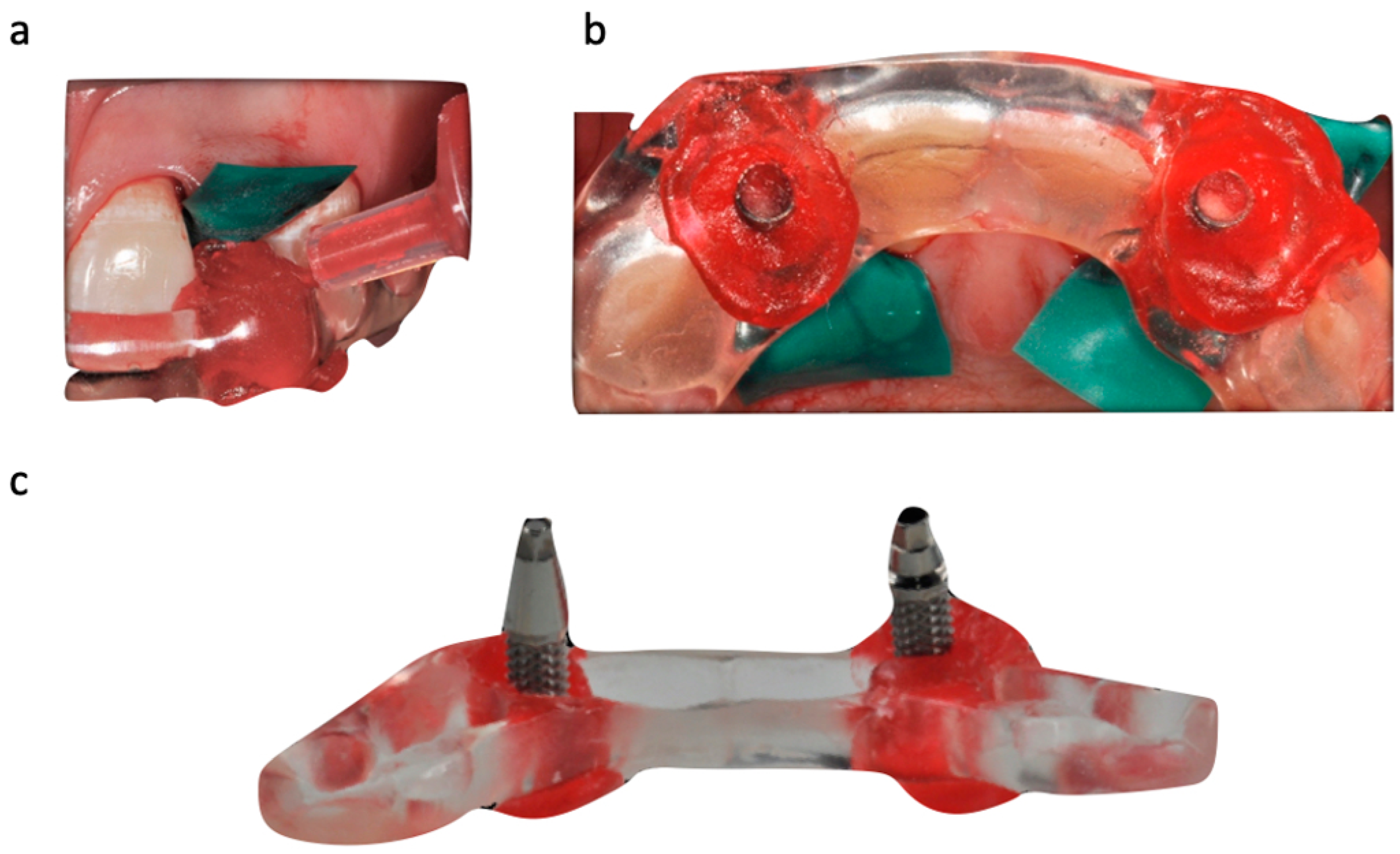 Prosthesis 05 00081 g008